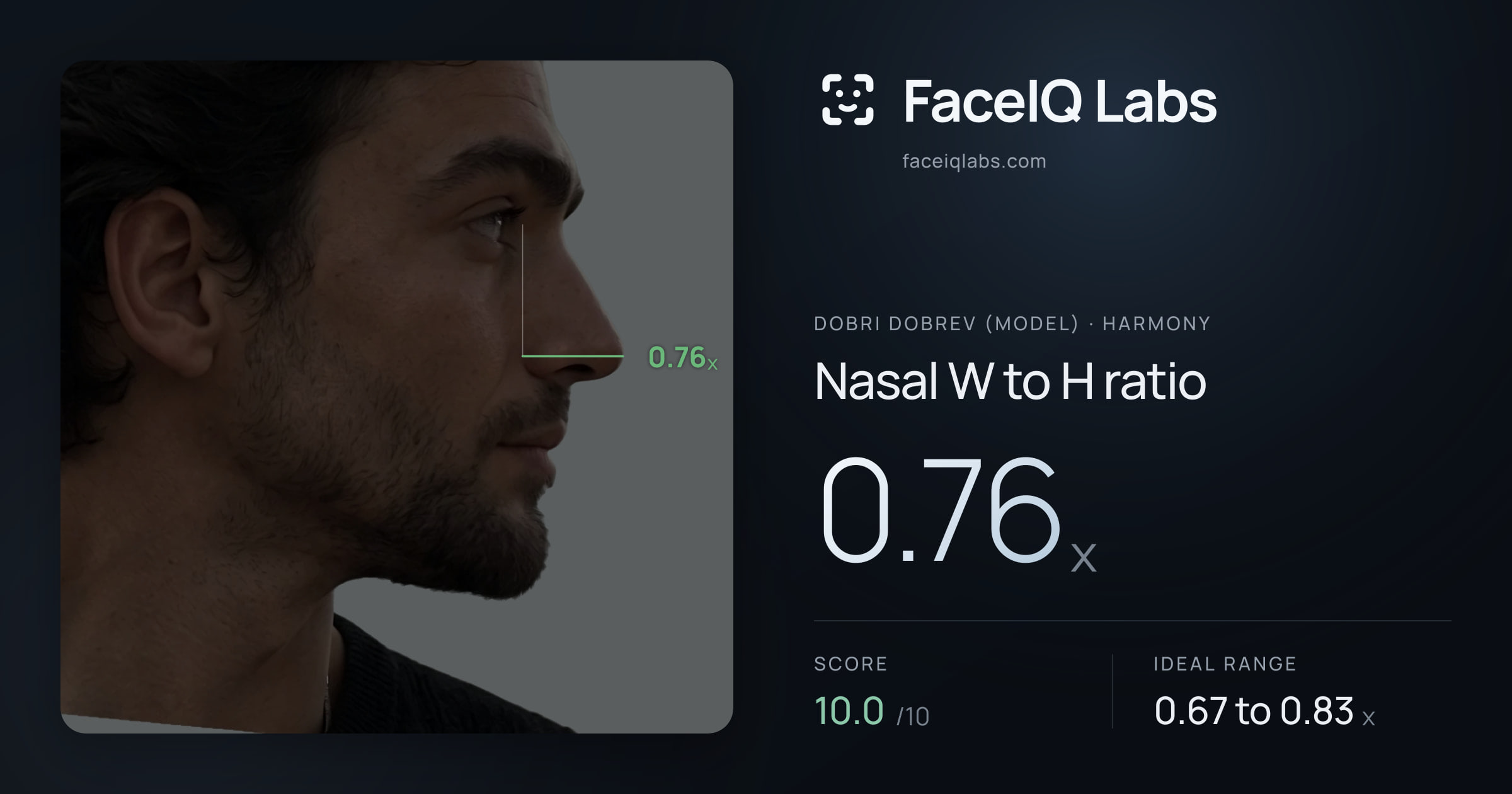 Dobri Dobrev (Model) Nasal W to H ratio: 0.76x, drawn on the photo
