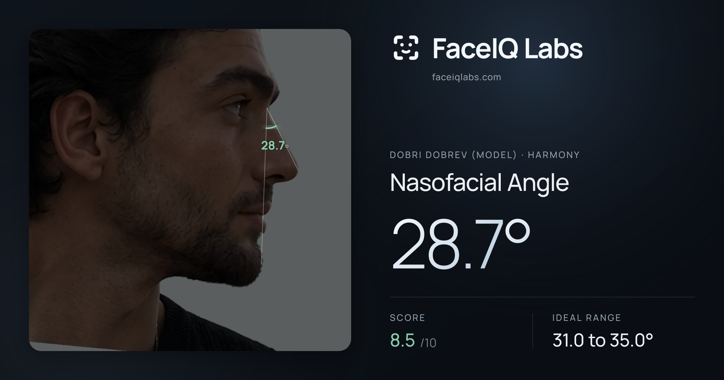 Dobri Dobrev (Model) Nasofacial Angle: 28.7°, drawn on the photo