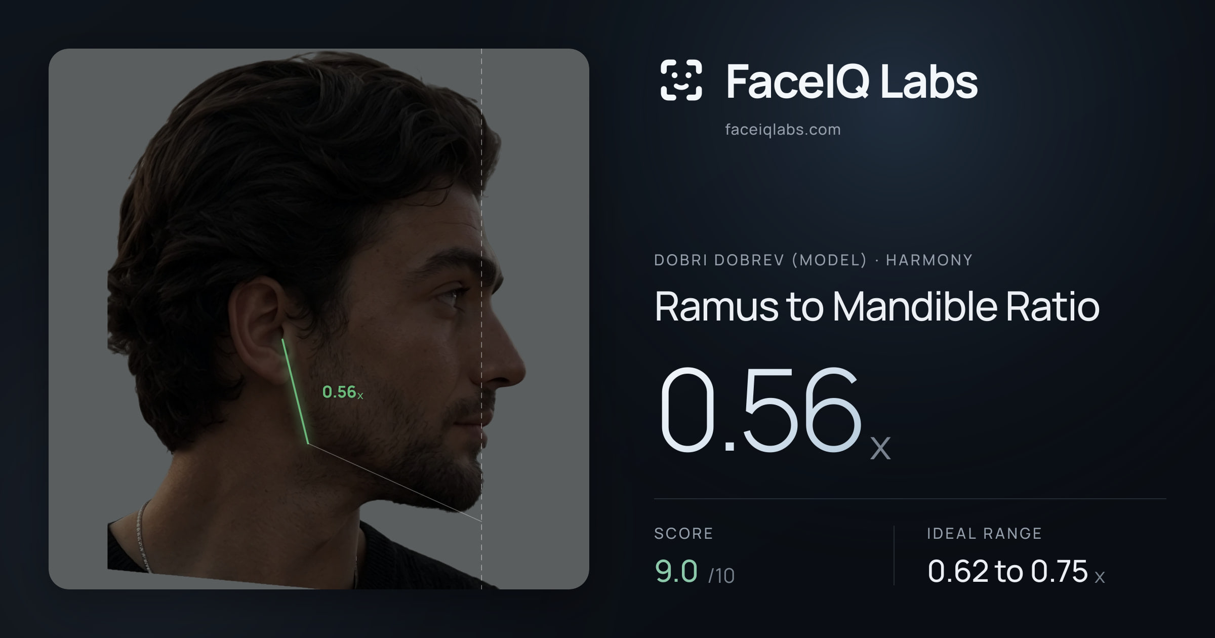Dobri Dobrev (Model) Ramus to Mandible Ratio: 0.56x, drawn on the photo
