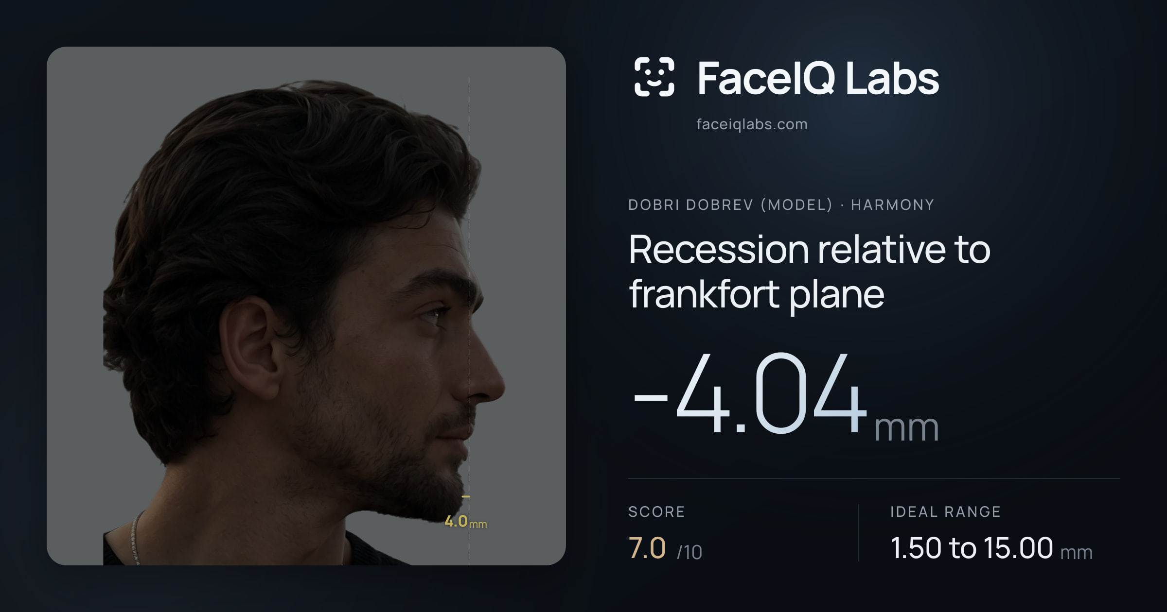 Dobri Dobrev (Model) Recession relative to frankfort plane: -4.04mm, drawn on the photo