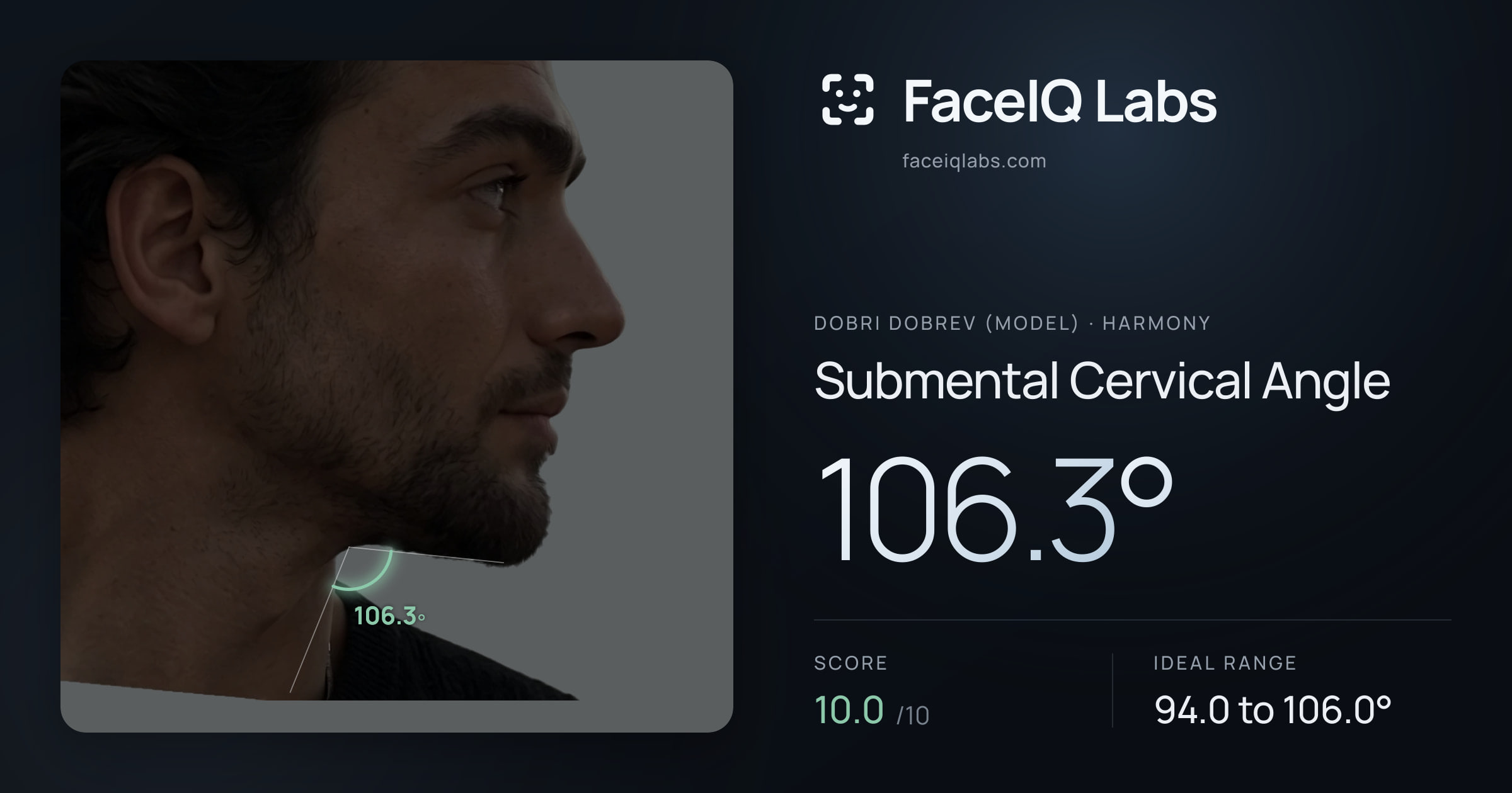 Dobri Dobrev (Model) Submental Cervical Angle: 106.3°, drawn on the photo