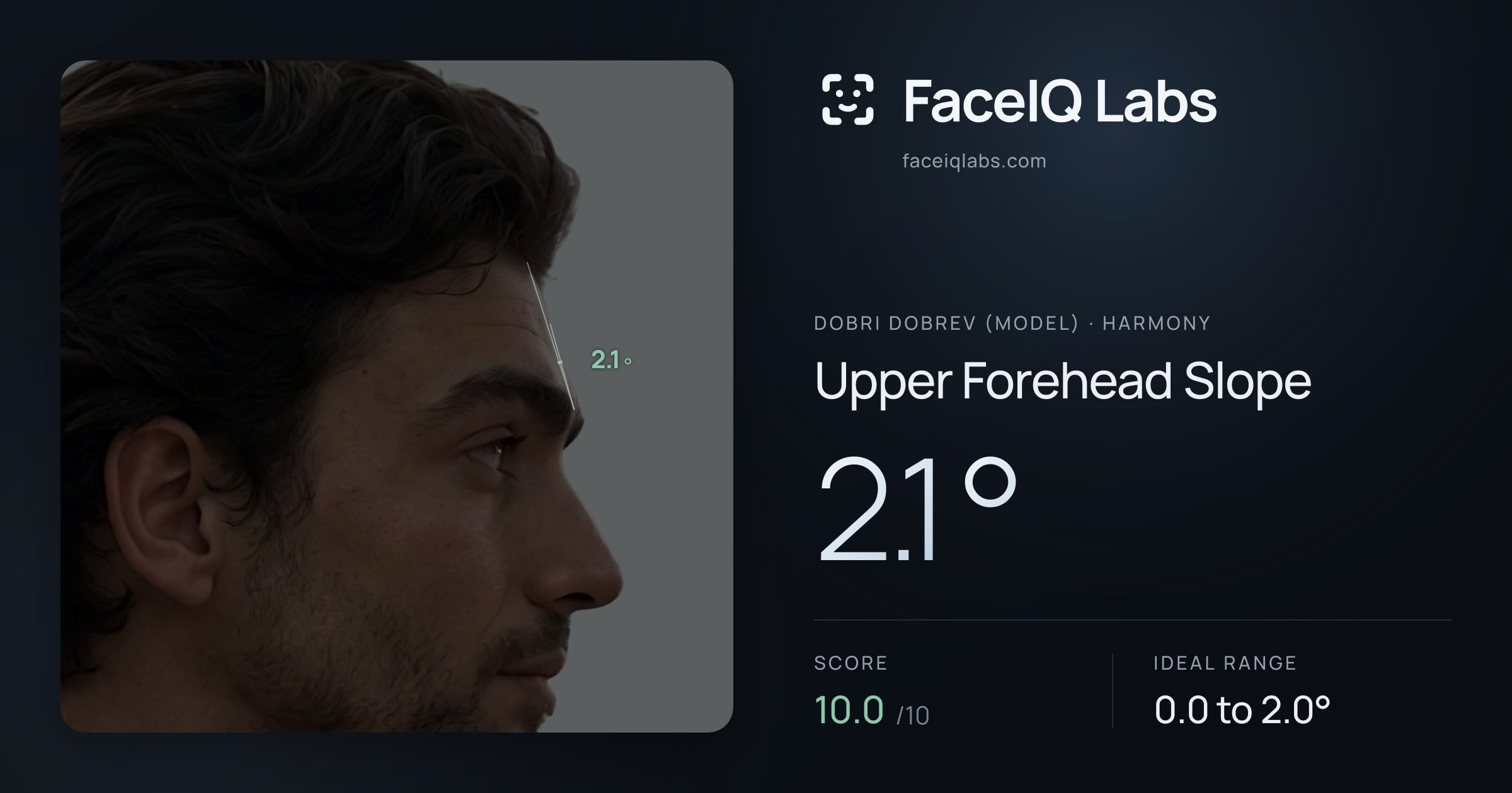 Dobri Dobrev (Model) Upper Forehead Slope: 2.1°, drawn on the photo