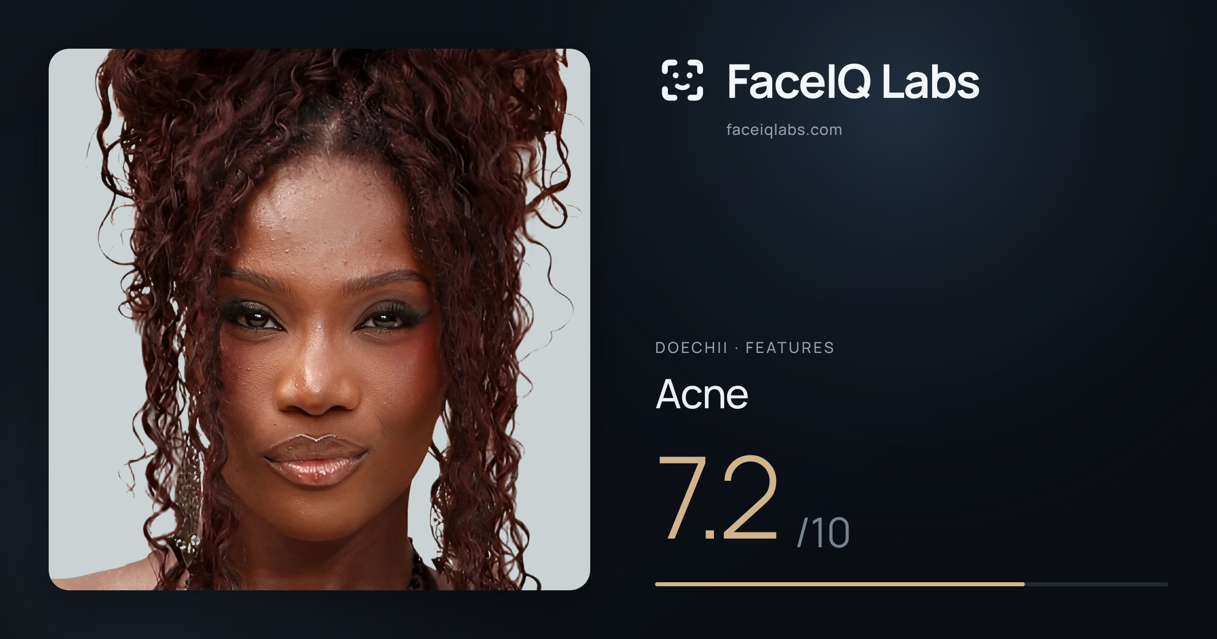 Doechii Acne: 7.2/10, drawn on the photo