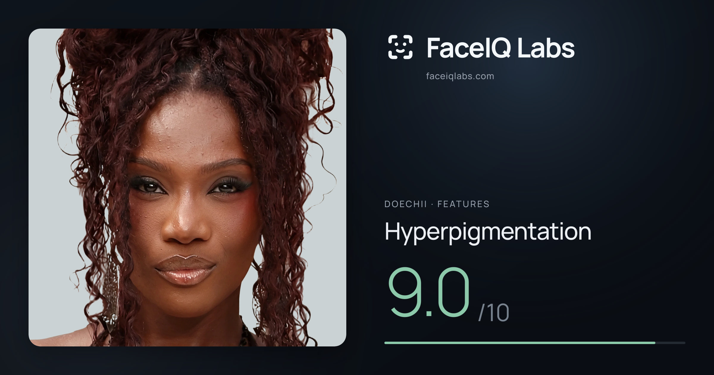 Doechii Hyperpigmentation: 9.0/10, drawn on the photo