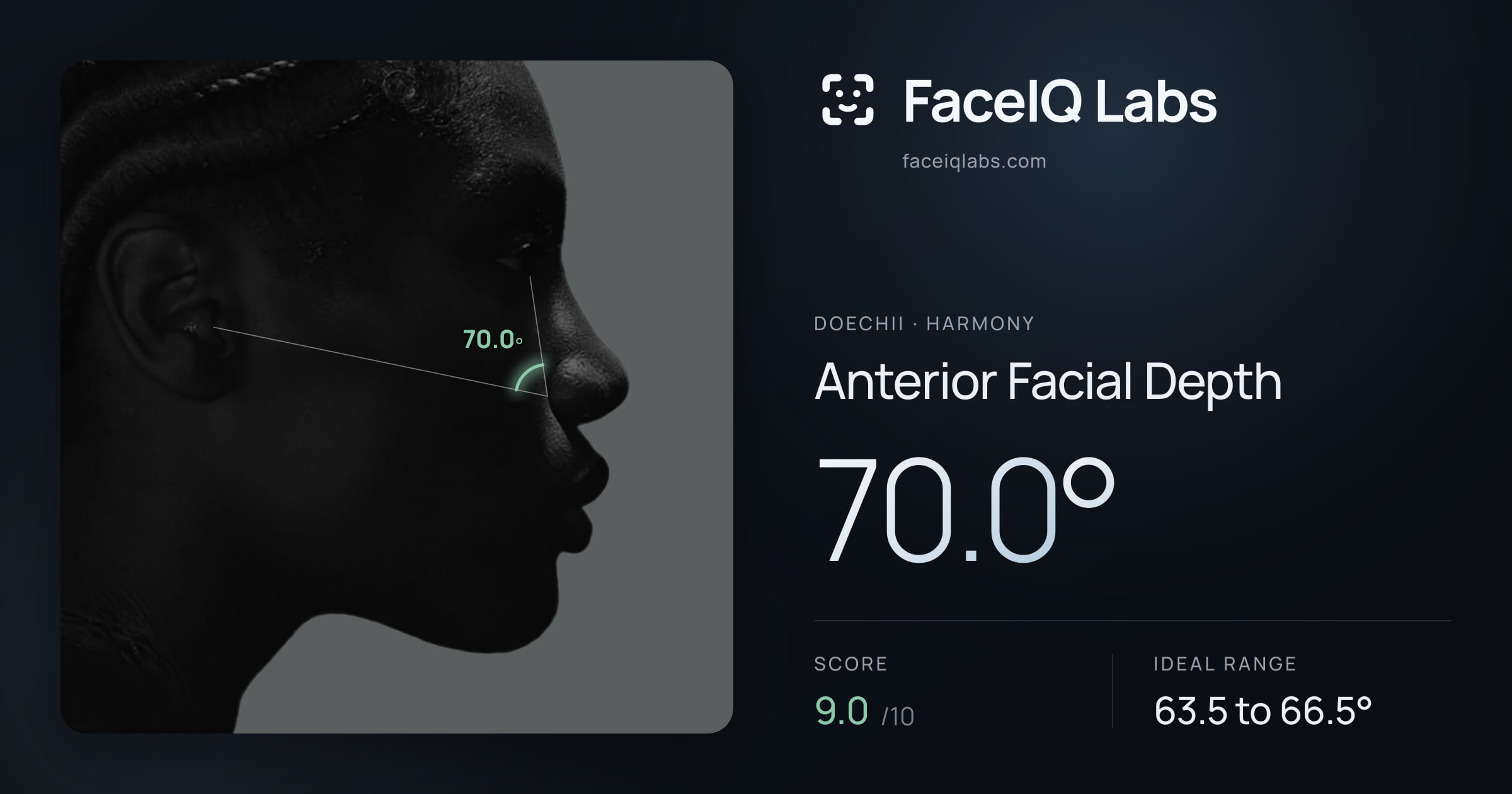 Doechii Anterior Facial Depth: 70.0°, drawn on the photo