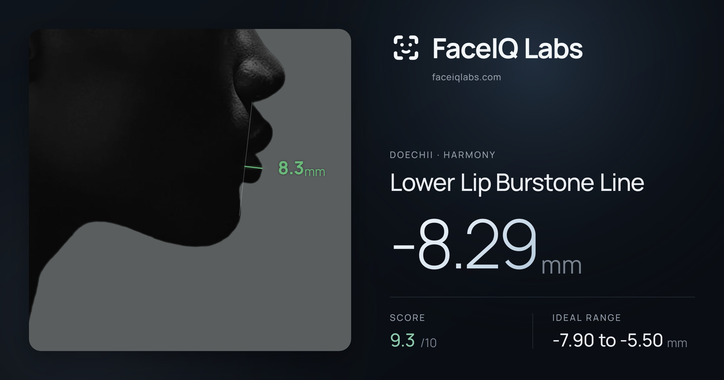 Doechii Lower Lip Burstone Line: -8.29mm, drawn on the photo