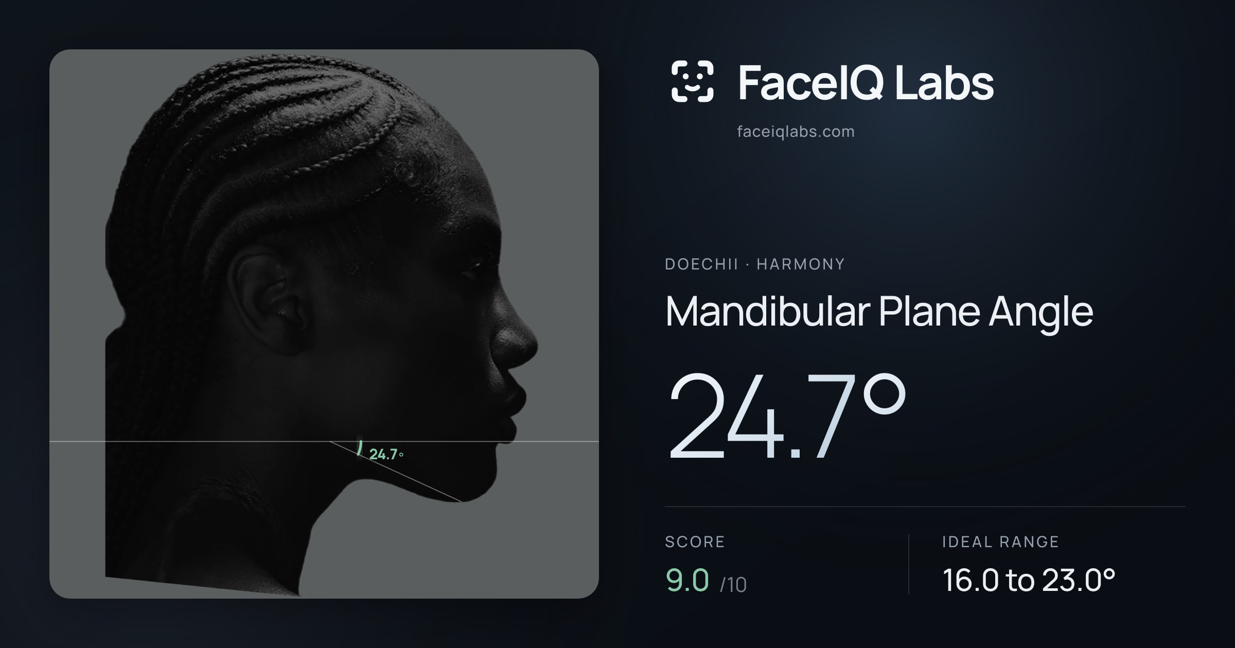 Doechii Mandibular Plane Angle: 24.7°, drawn on the photo