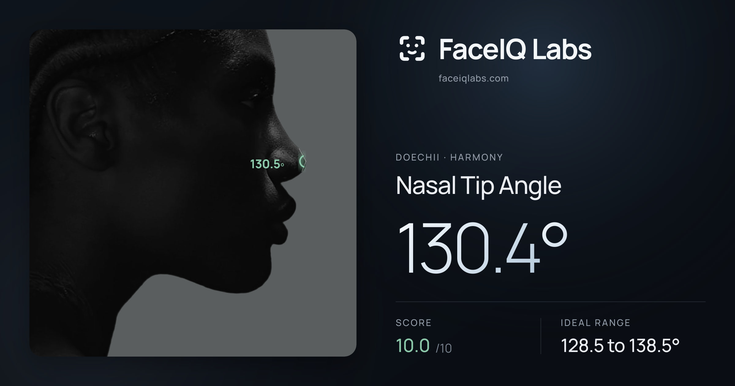 Doechii Nasal Tip Angle: 130.4°, drawn on the photo
