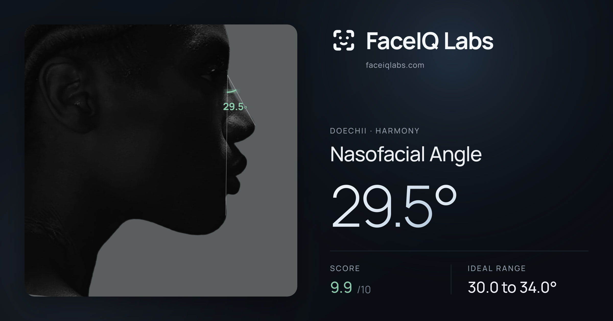 Doechii Nasofacial Angle: 29.5°, drawn on the photo