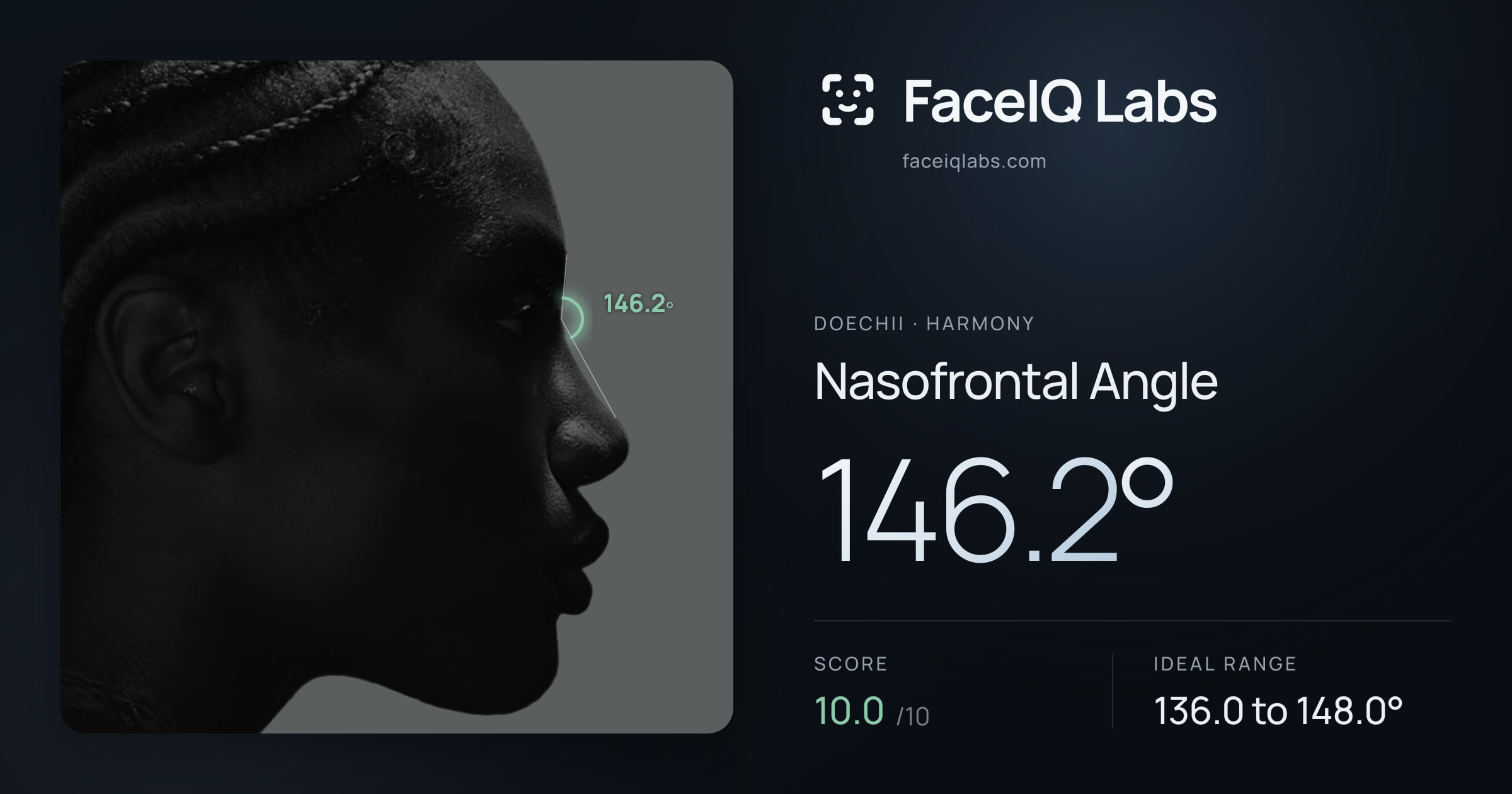 Doechii Nasofrontal Angle: 146.2°, drawn on the photo