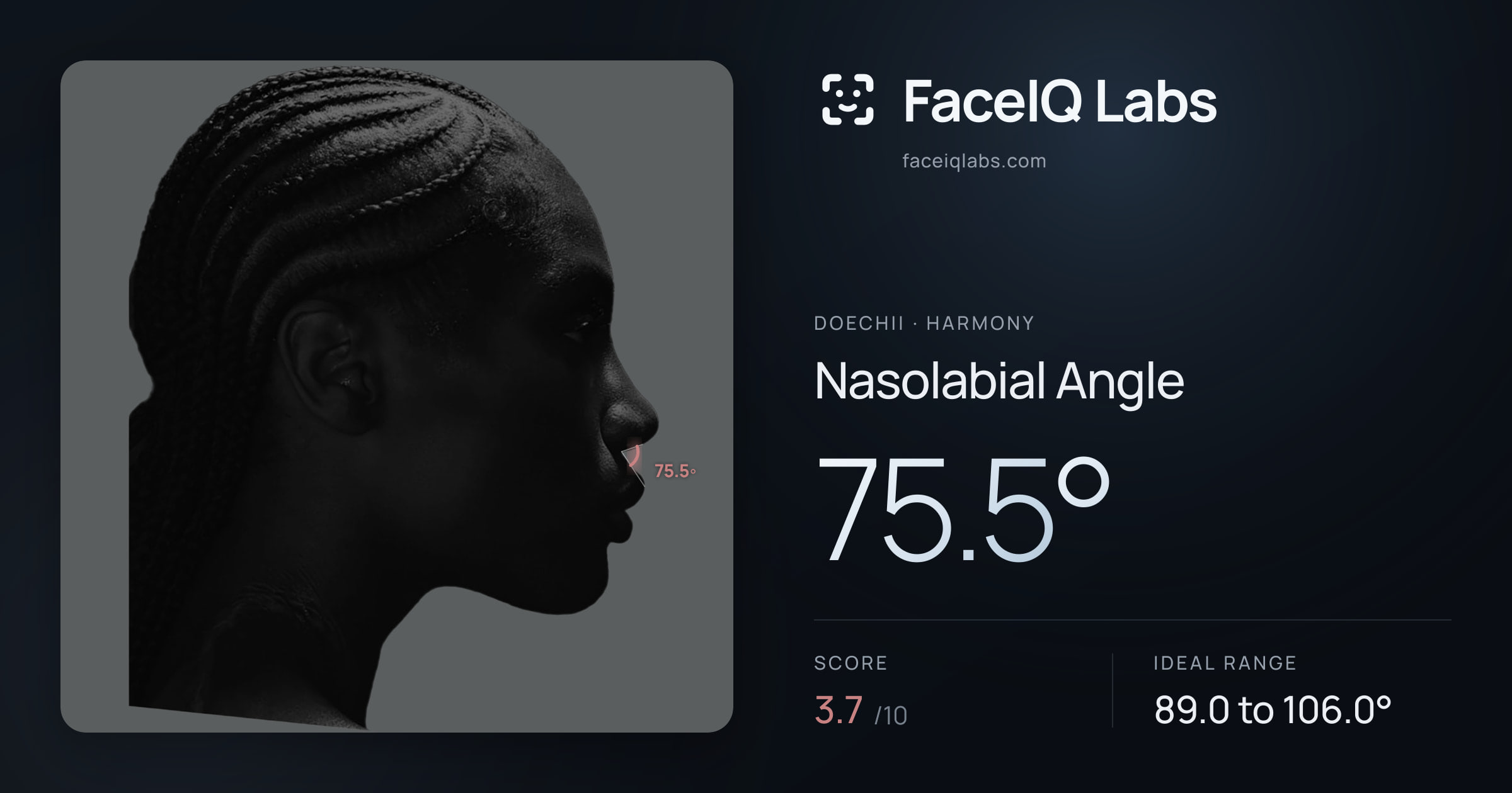 Doechii Nasolabial Angle: 75.5°, drawn on the photo
