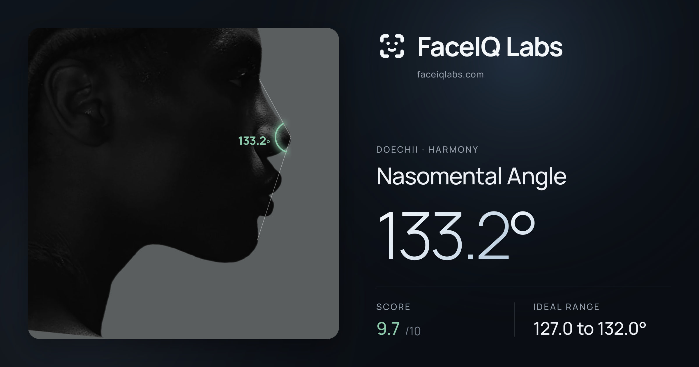 Doechii Nasomental Angle: 133.2°, drawn on the photo
