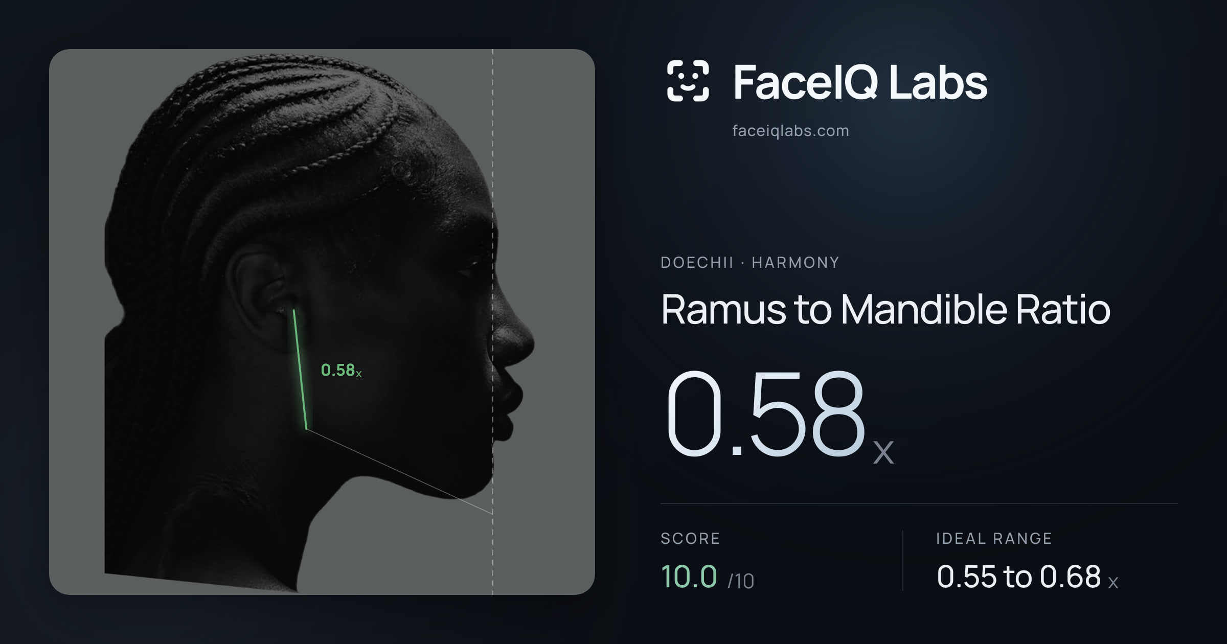 Doechii Ramus to Mandible Ratio: 0.58x, drawn on the photo