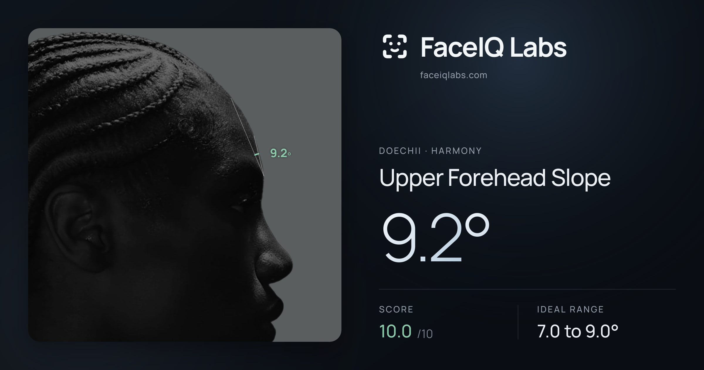 Doechii Upper Forehead Slope: 9.2°, drawn on the photo
