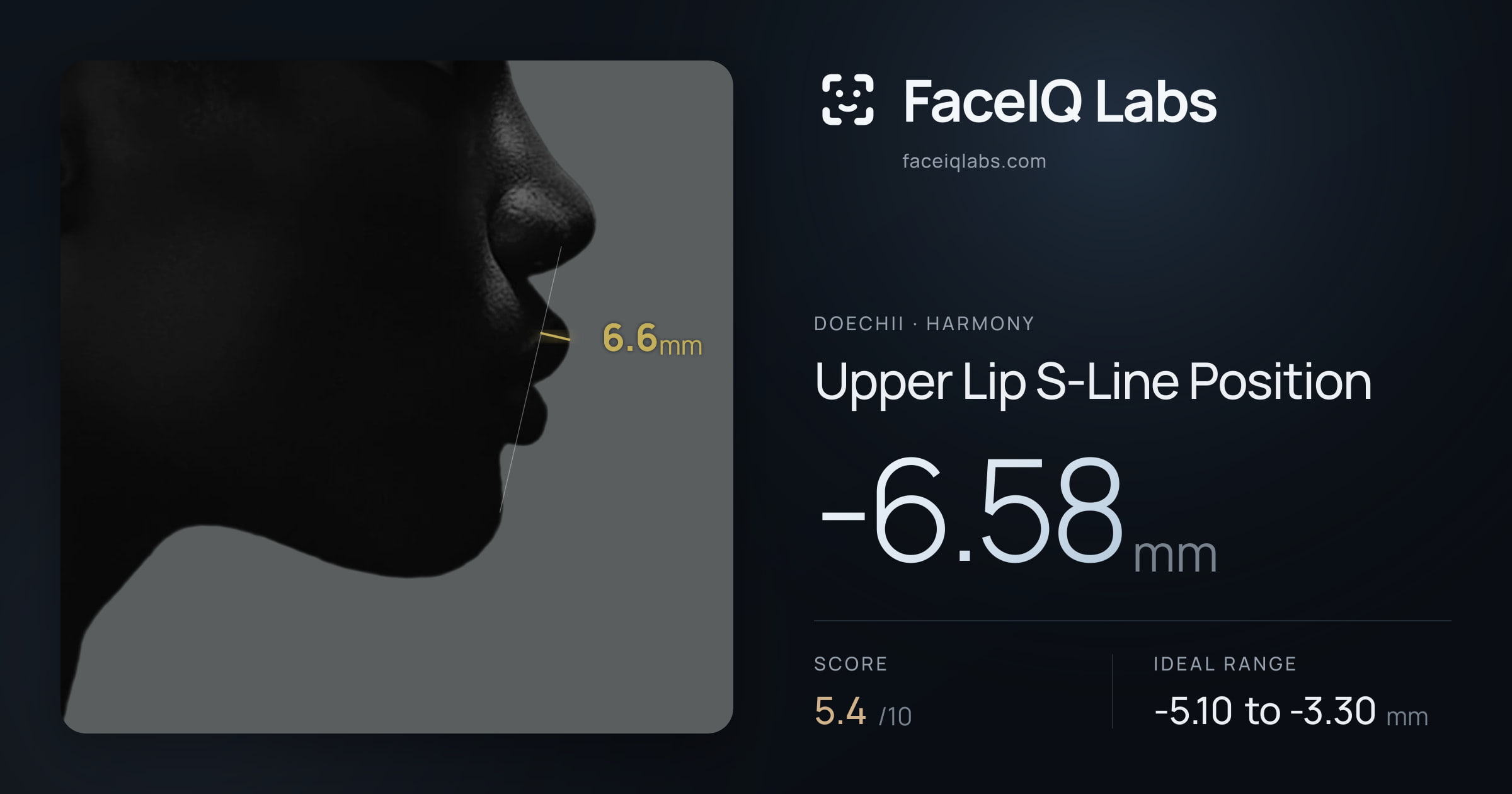 Doechii Upper Lip S-Line Position: -6.58mm, drawn on the photo