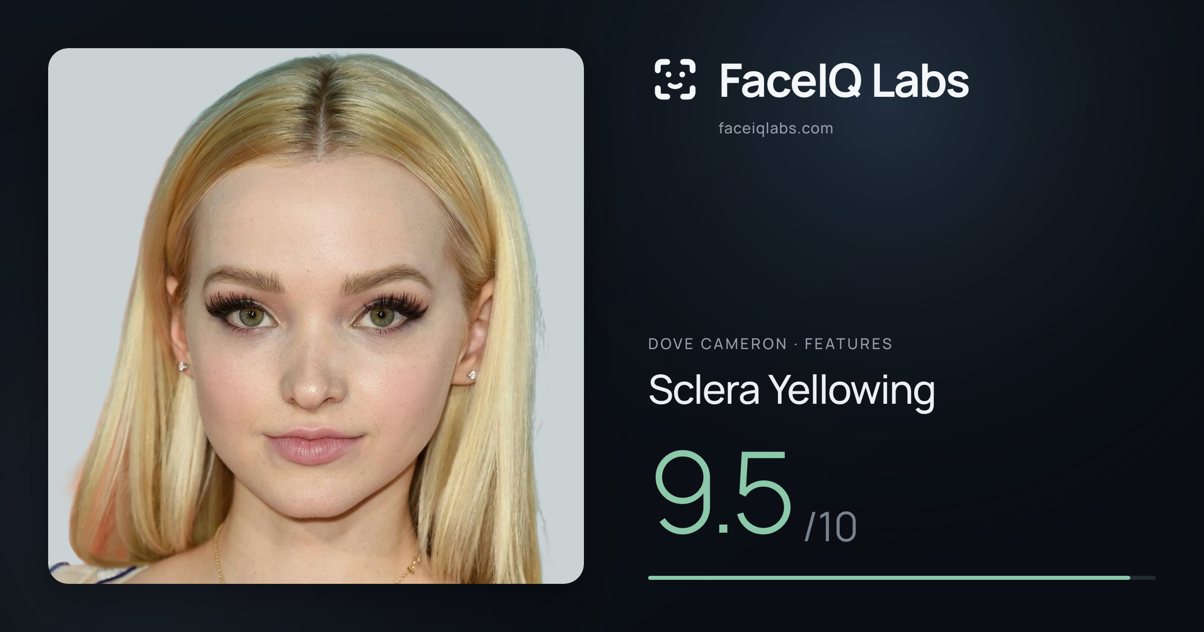 Dove Cameron Sclera Yellowing: 9.5/10, drawn on the photo
