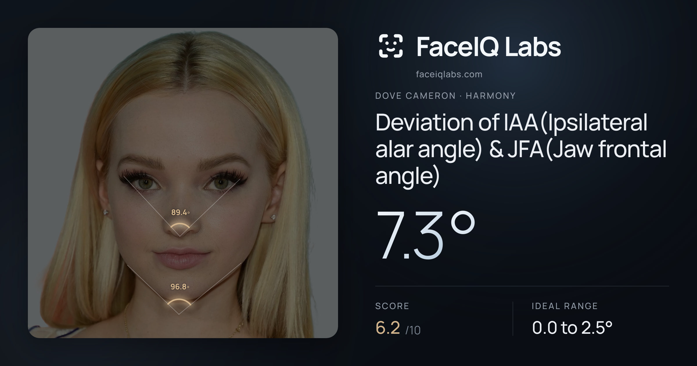 Dove Cameron Deviation of IAA(Ipsilateral alar angle) & JFA(Jaw frontal angle): 7.3°, drawn on the photo
