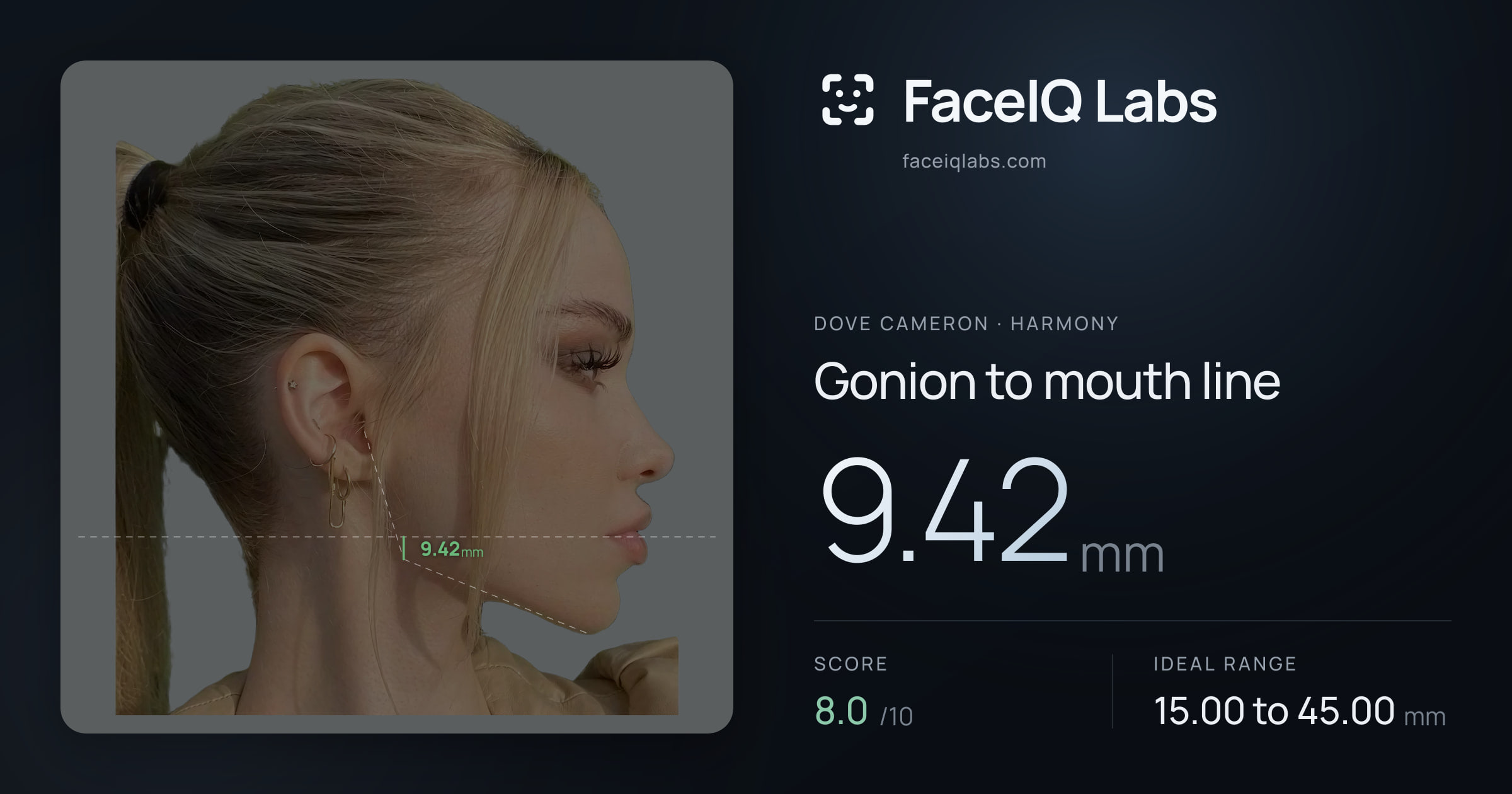 Dove Cameron Gonion to mouth line: 9.42mm, drawn on the photo