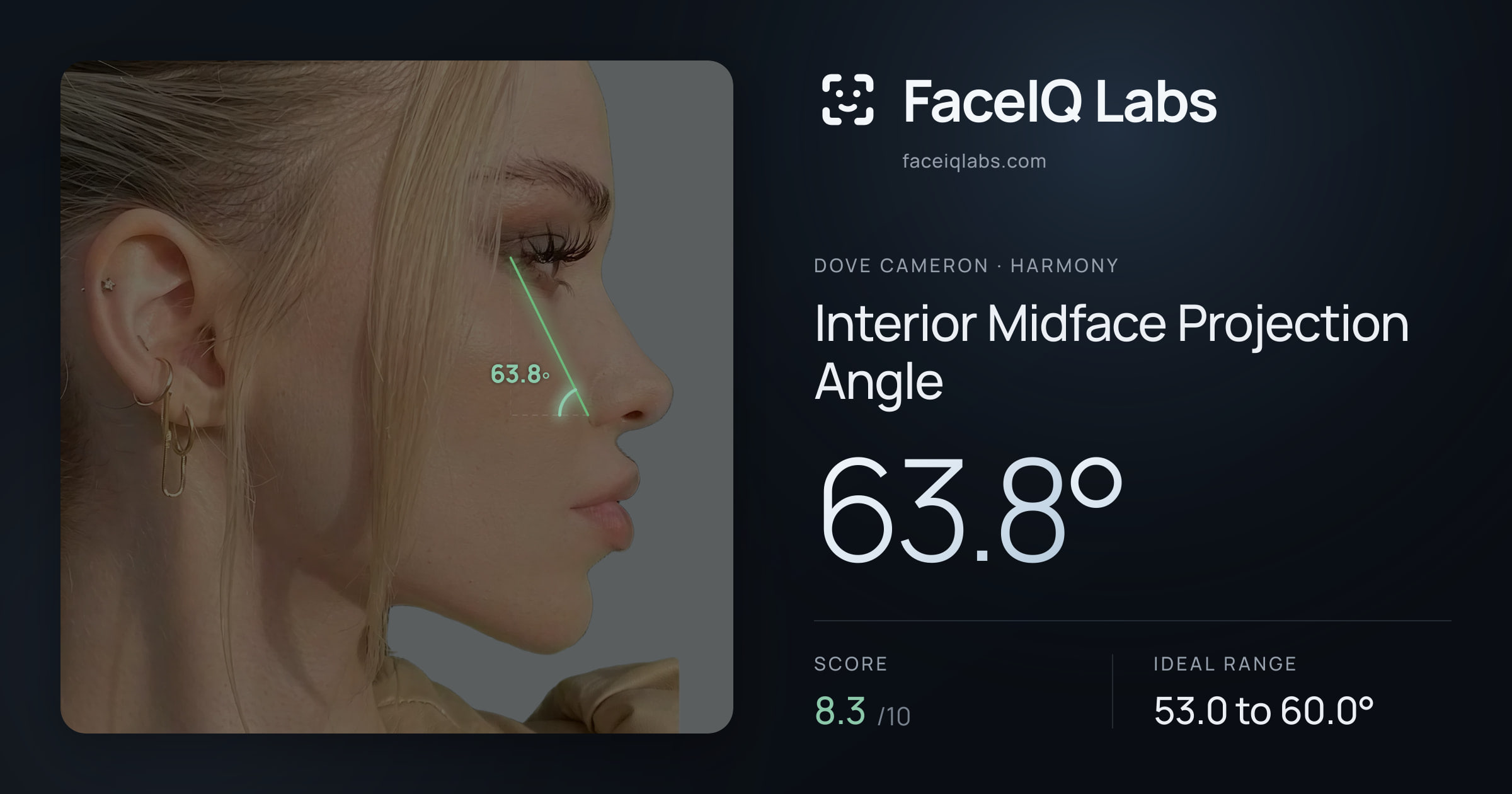 Dove Cameron Interior Midface Projection Angle: 63.8°, drawn on the photo