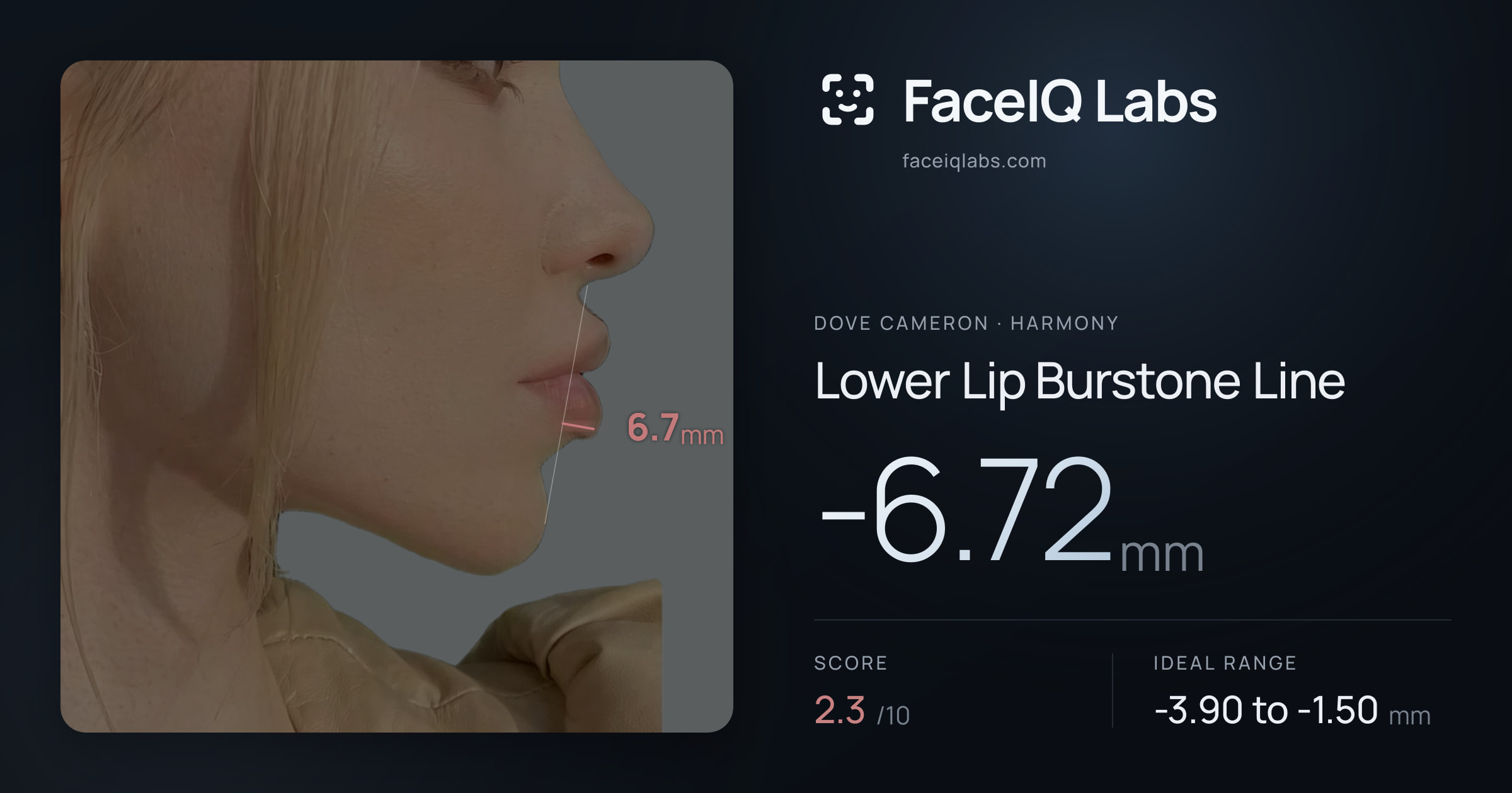 Dove Cameron Lower Lip Burstone Line: -6.72mm, drawn on the photo