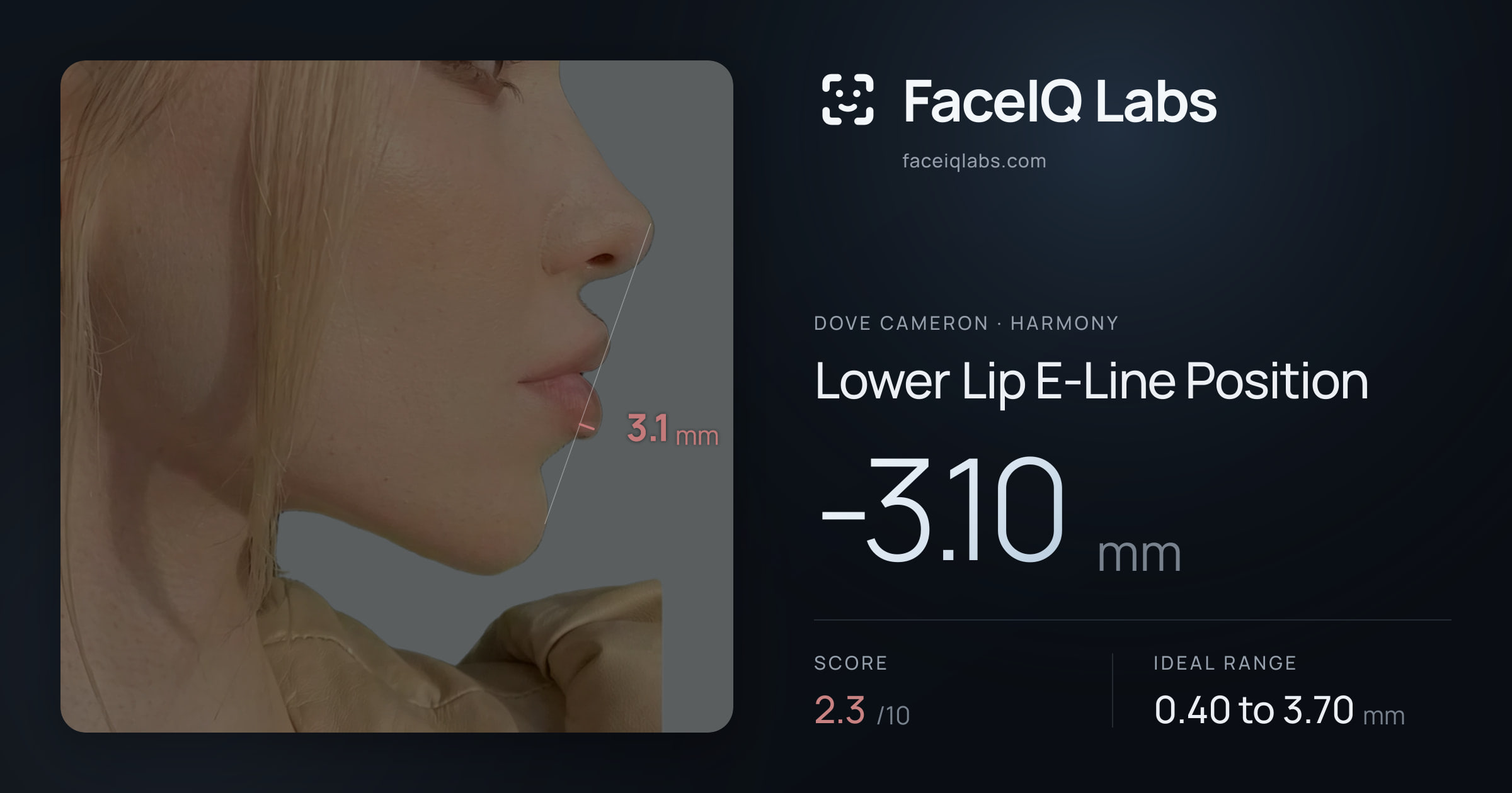 Dove Cameron Lower Lip E-Line Position: -3.10mm, drawn on the photo