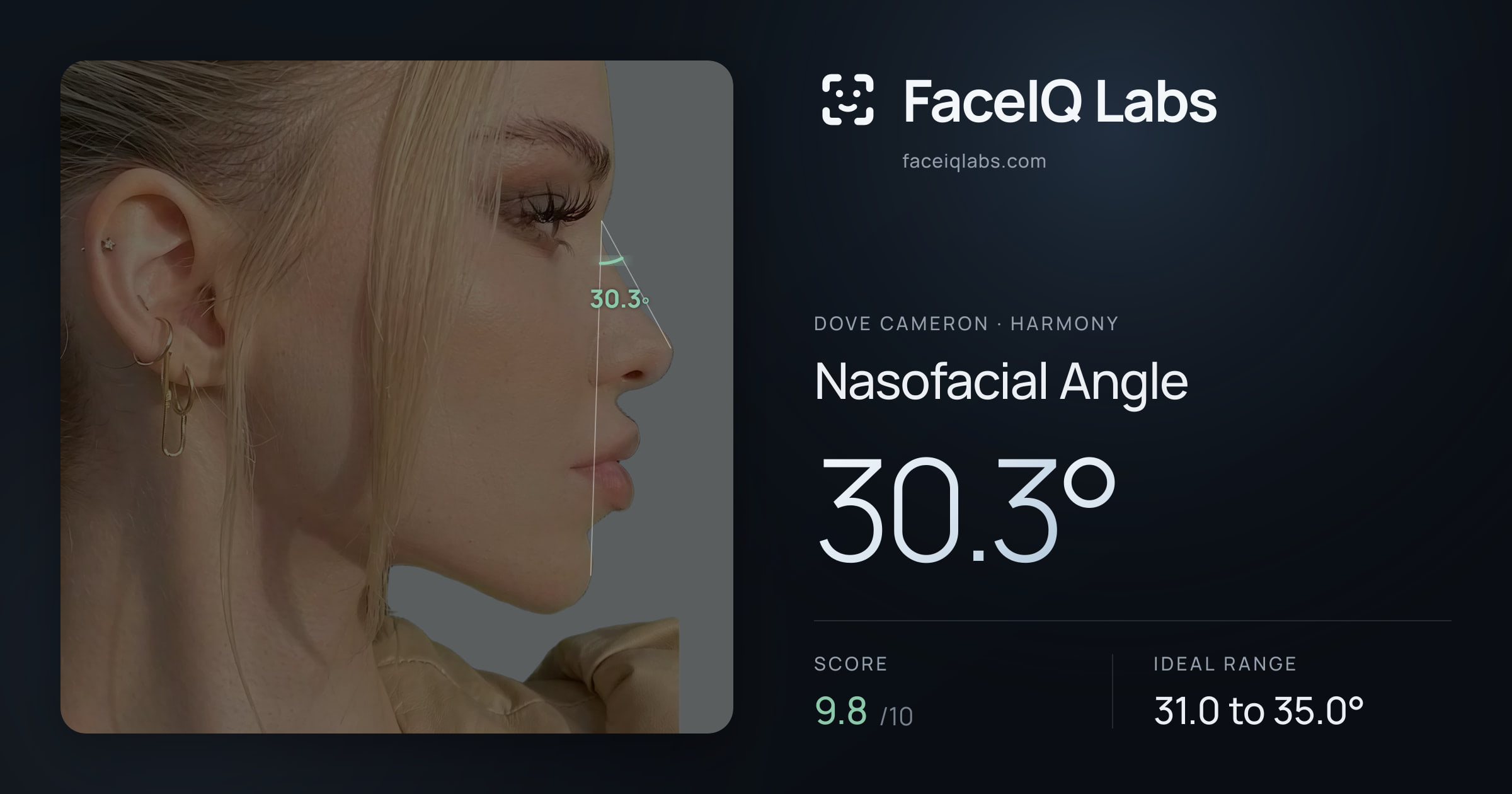 Dove Cameron Nasofacial Angle: 30.3°, drawn on the photo