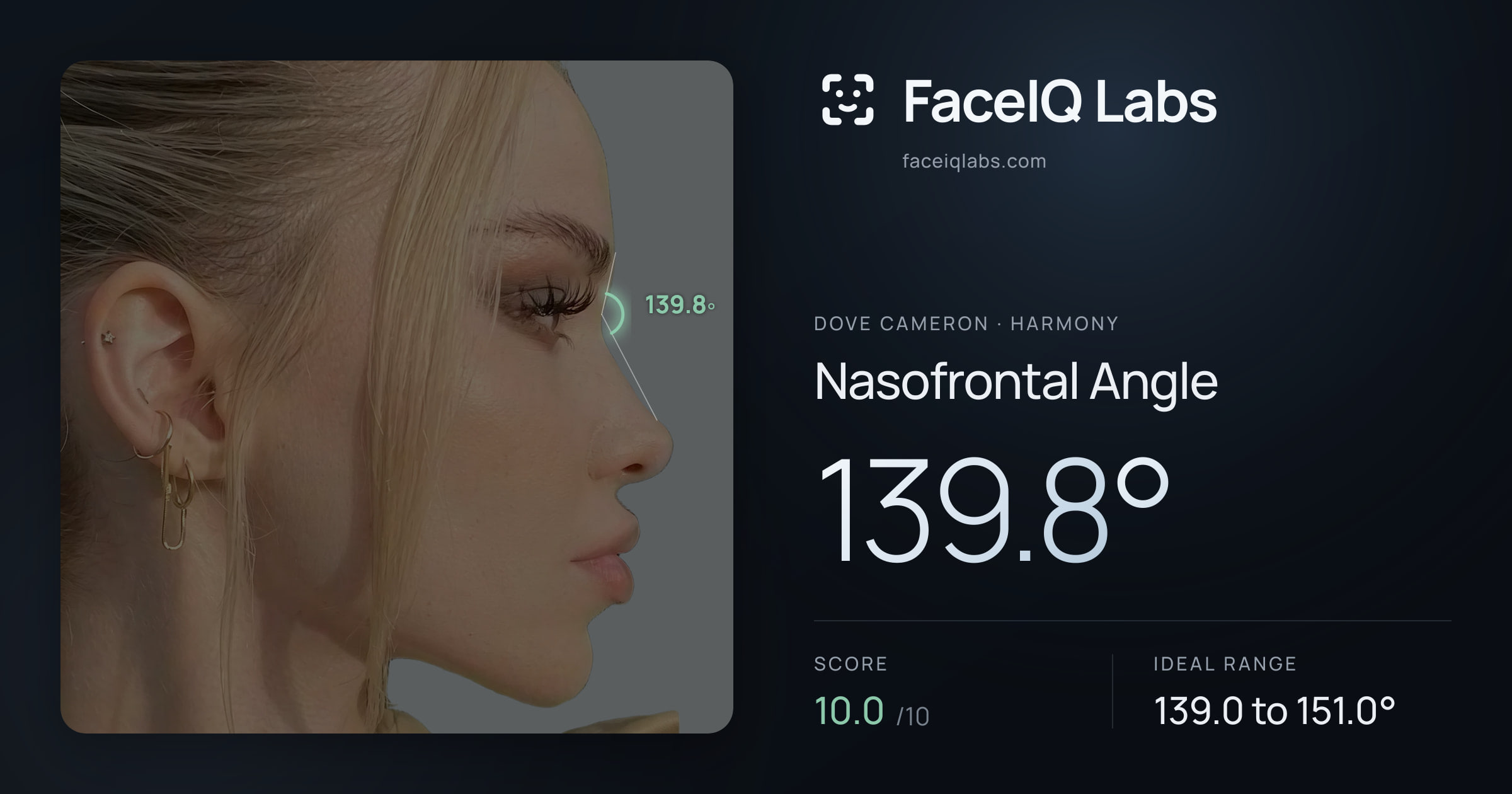 Dove Cameron Nasofrontal Angle: 139.8°, drawn on the photo