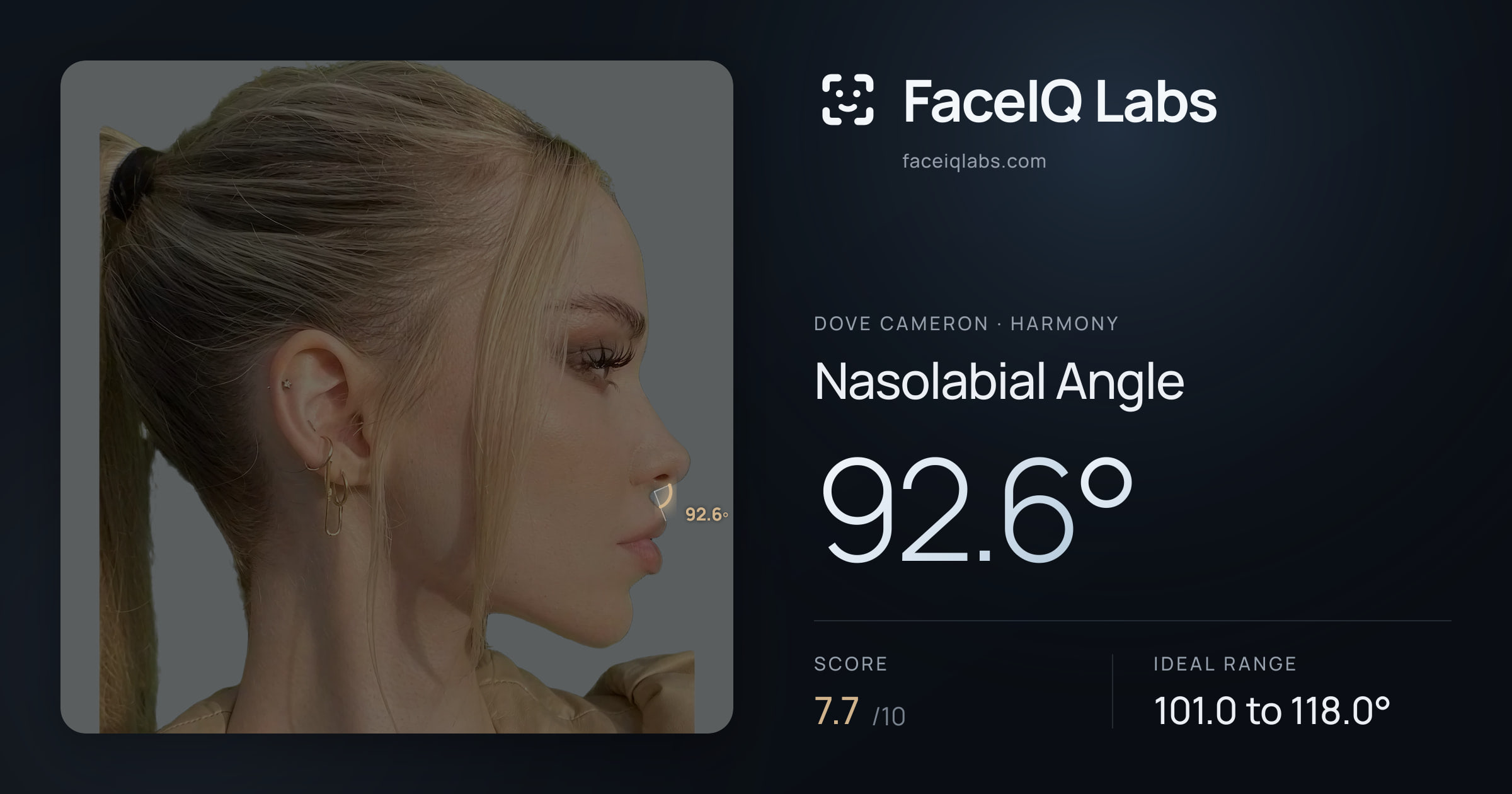 Dove Cameron Nasolabial Angle: 92.6°, drawn on the photo