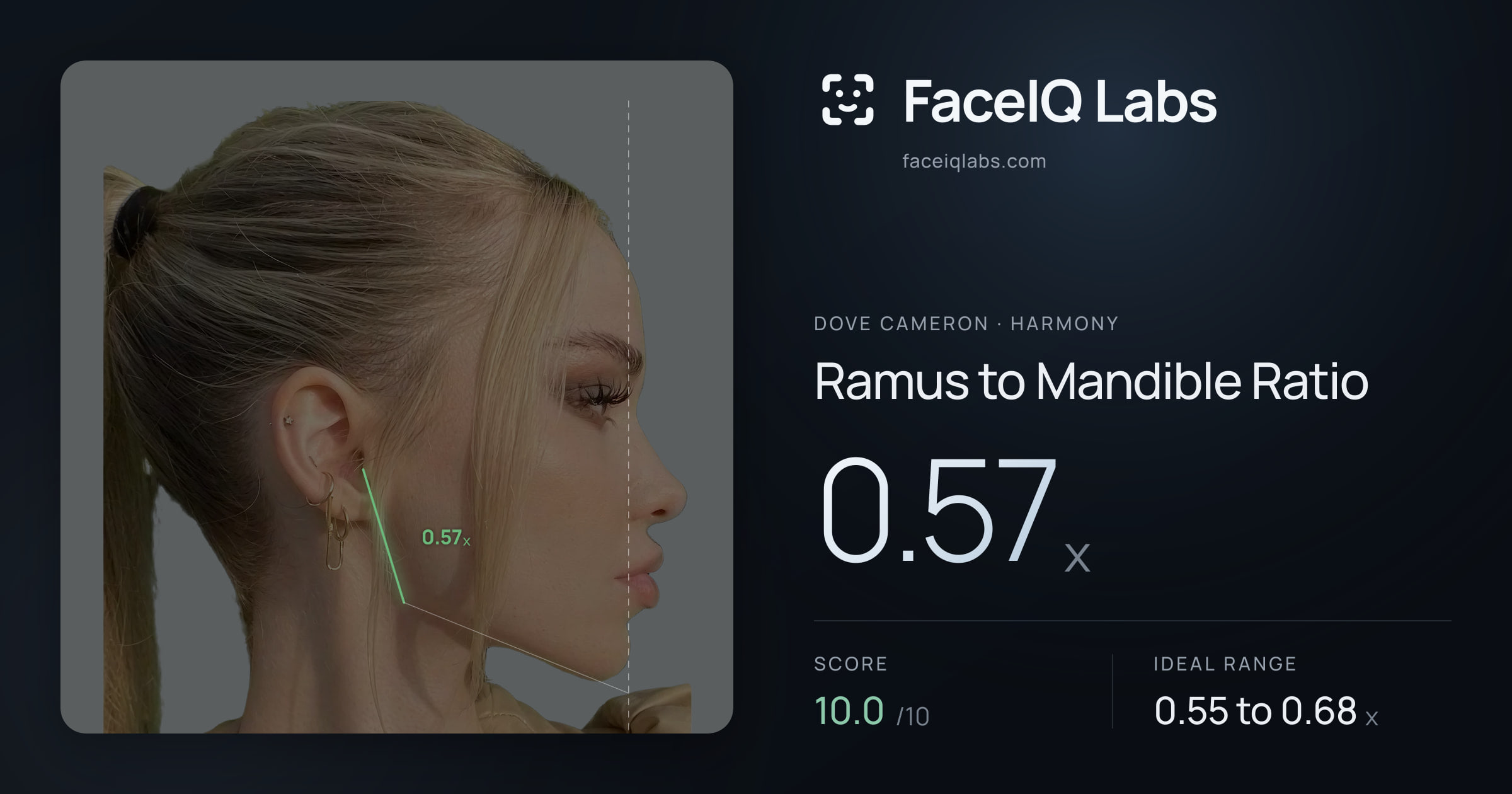 Dove Cameron Ramus to Mandible Ratio: 0.57x, drawn on the photo