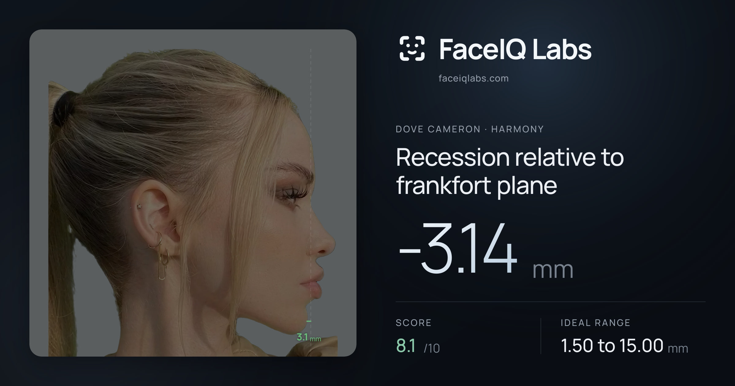 Dove Cameron Recession relative to frankfort plane: -3.14mm, drawn on the photo