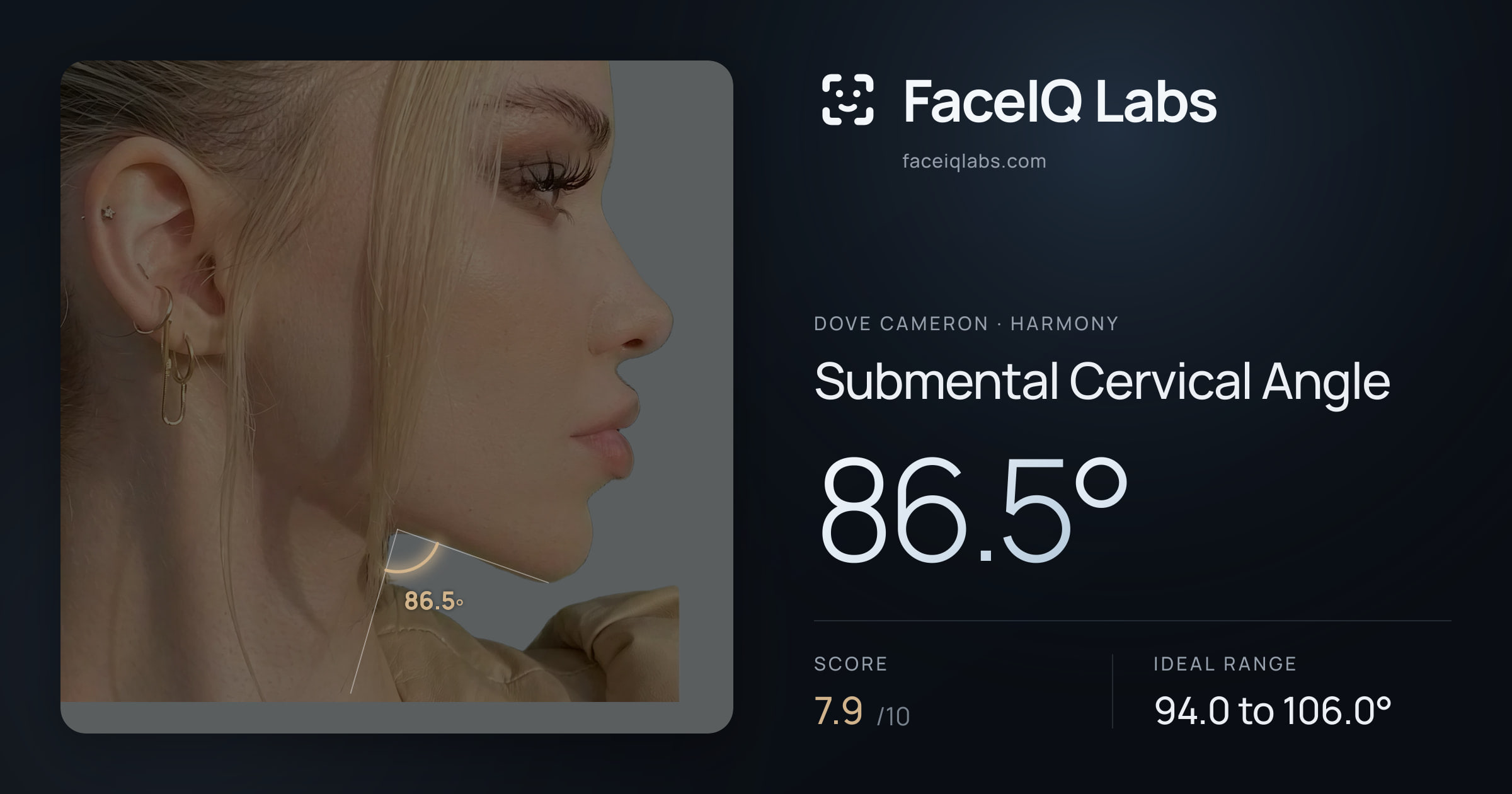Dove Cameron Submental Cervical Angle: 86.5°, drawn on the photo