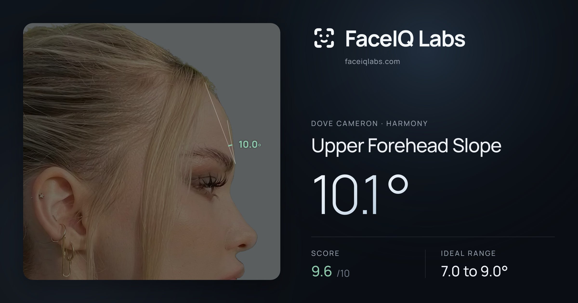 Dove Cameron Upper Forehead Slope: 10.1°, drawn on the photo