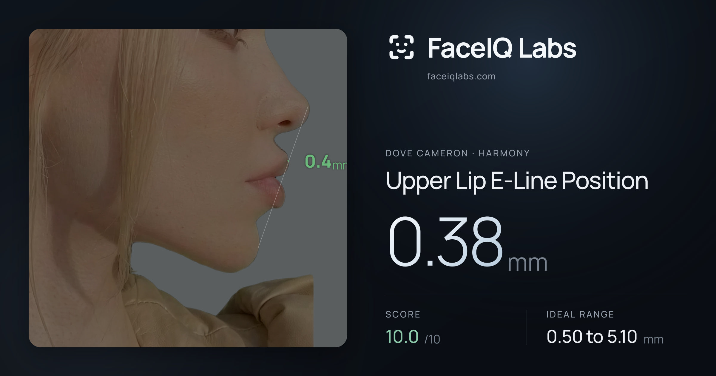 Dove Cameron Upper Lip E-Line Position: 0.38mm, drawn on the photo