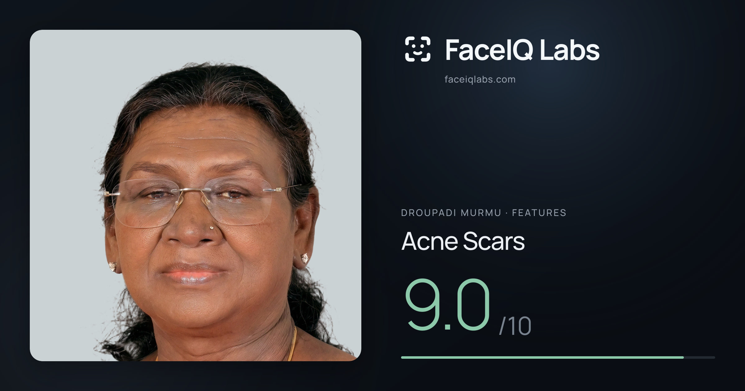 Droupadi Murmu Acne Scars: 9.0/10, drawn on the photo