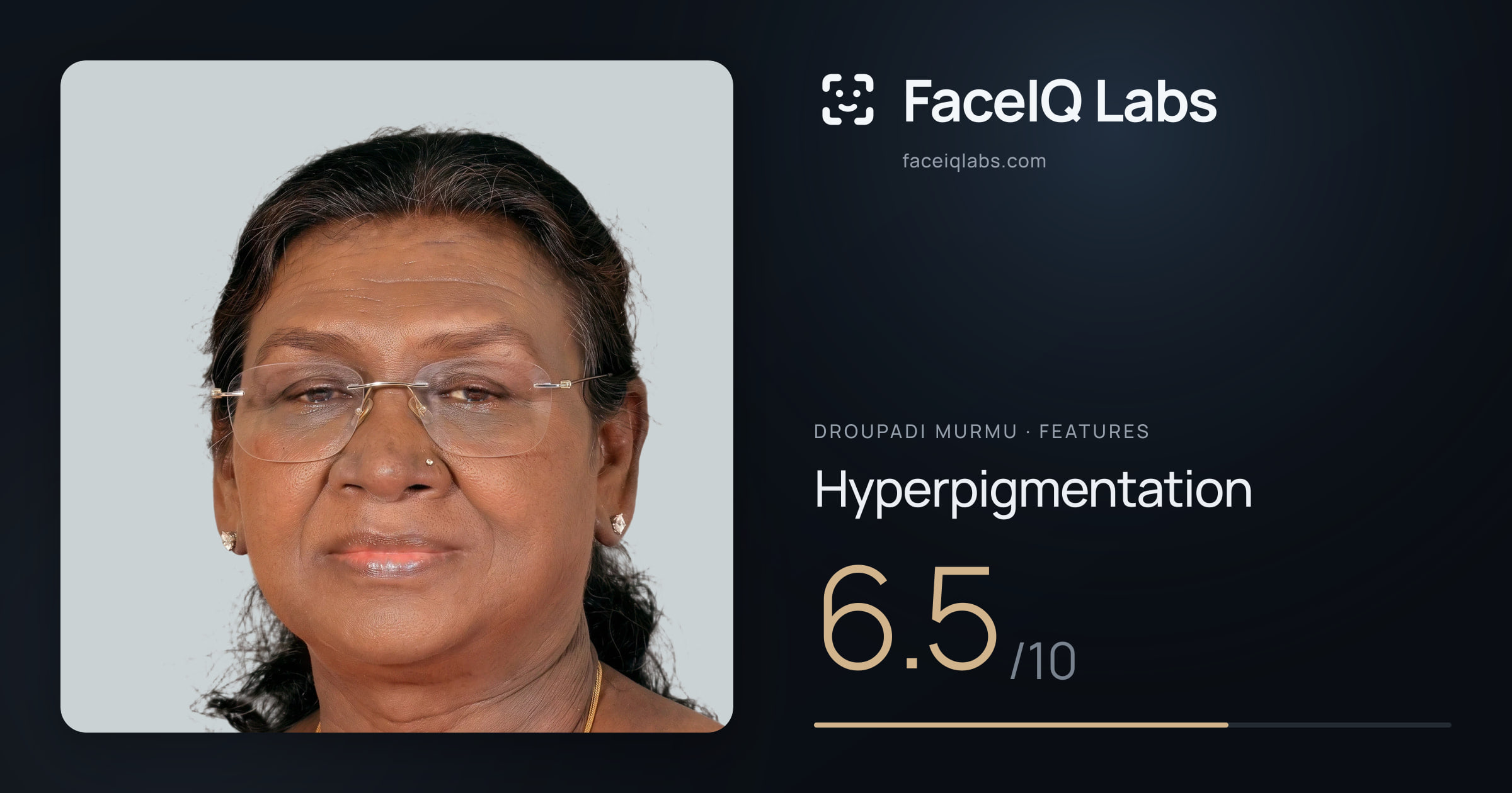 Droupadi Murmu Hyperpigmentation: 6.5/10, drawn on the photo