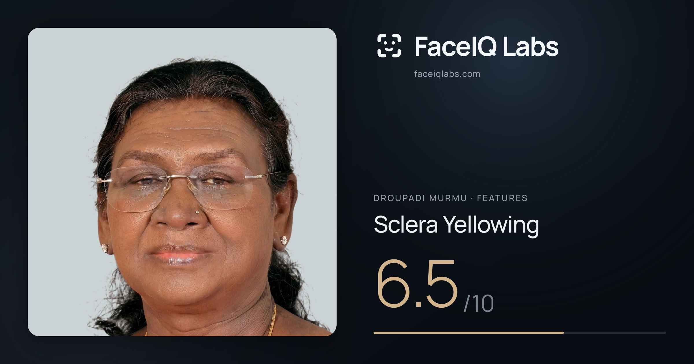 Droupadi Murmu Sclera Yellowing: 6.5/10, drawn on the photo