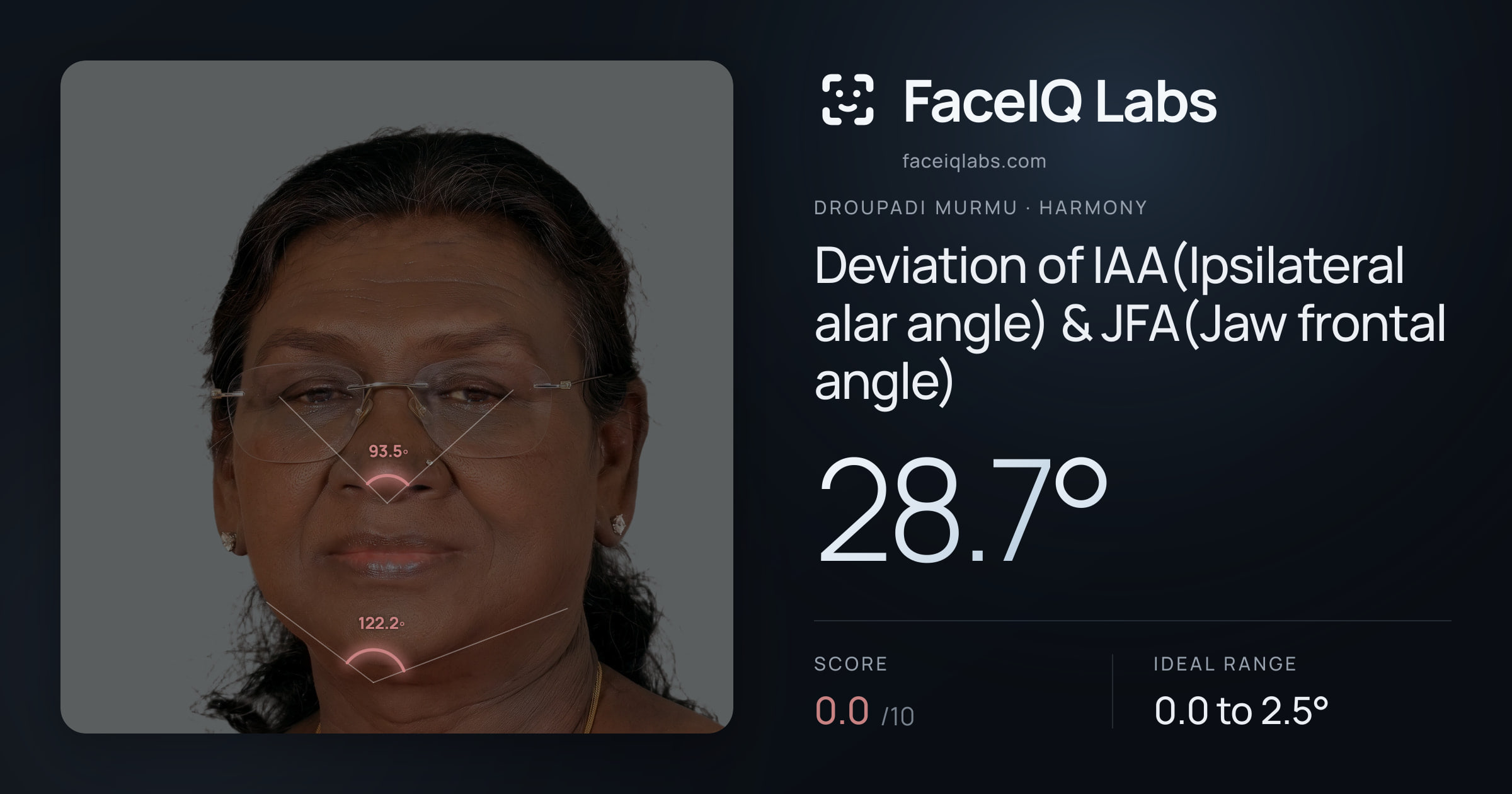 Droupadi Murmu Deviation of IAA(Ipsilateral alar angle) & JFA(Jaw frontal angle): 28.7°, drawn on the photo