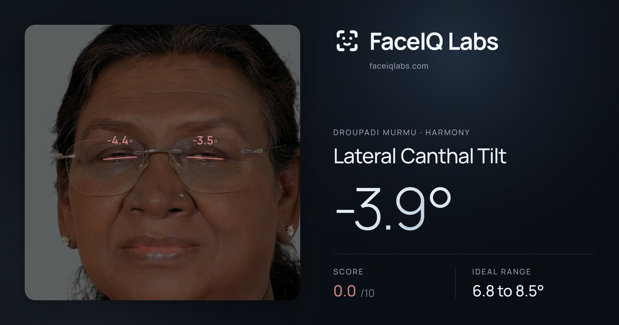 Droupadi Murmu Lateral Canthal Tilt: -3.9°, drawn on the photo