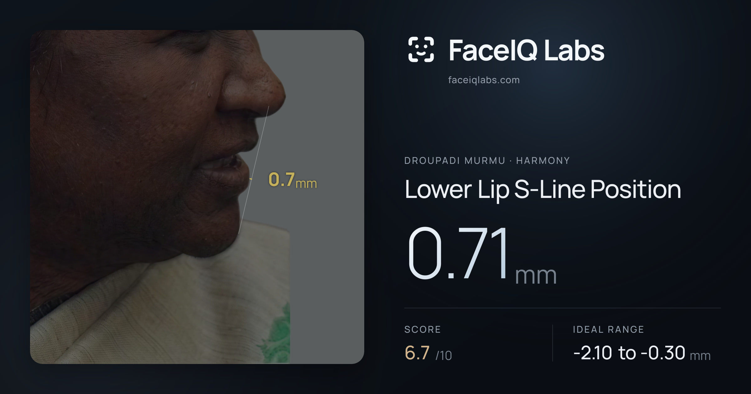 Droupadi Murmu Lower Lip S-Line Position: 0.71mm, drawn on the photo