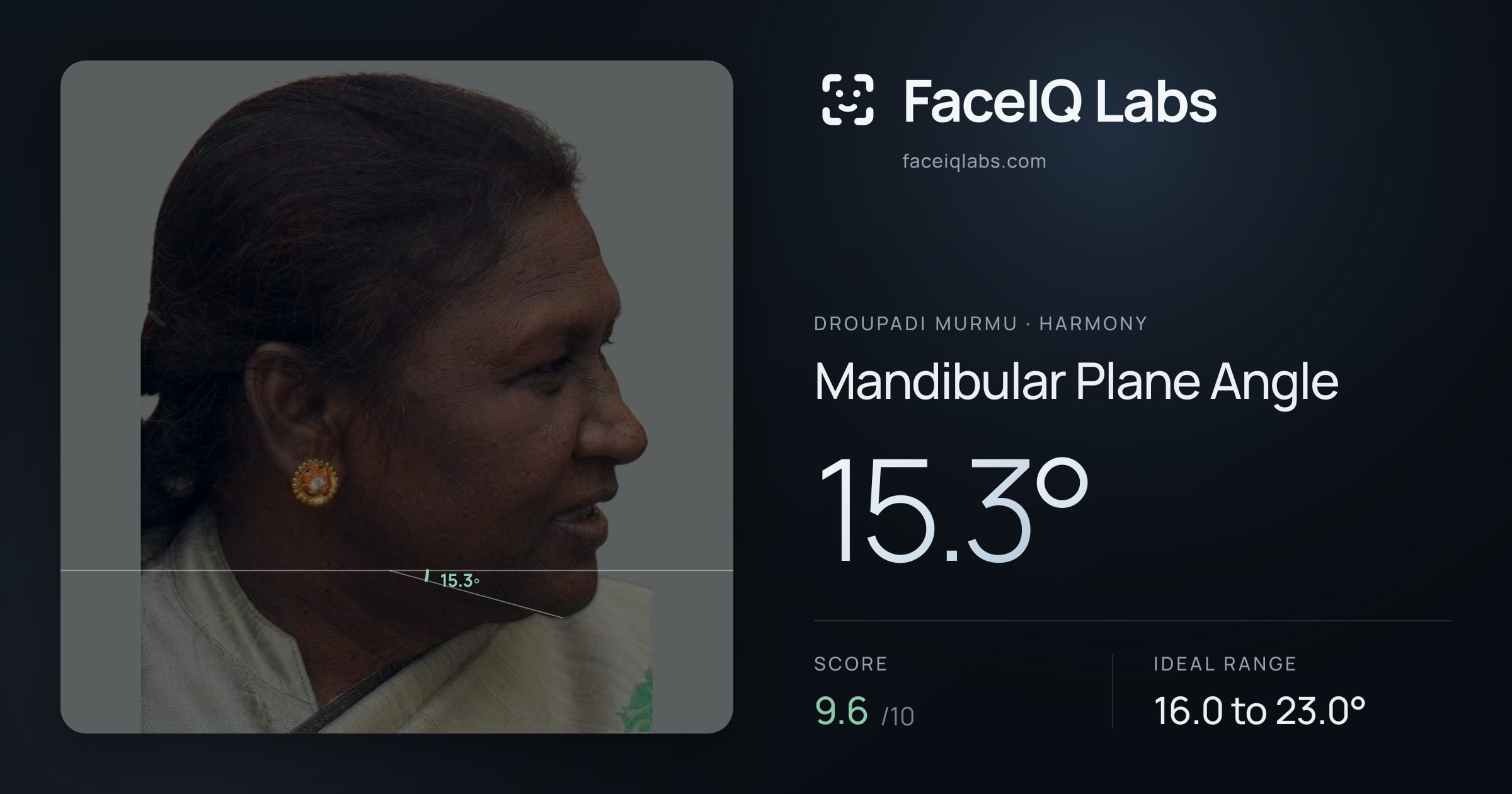 Droupadi Murmu Mandibular Plane Angle: 15.3°, drawn on the photo