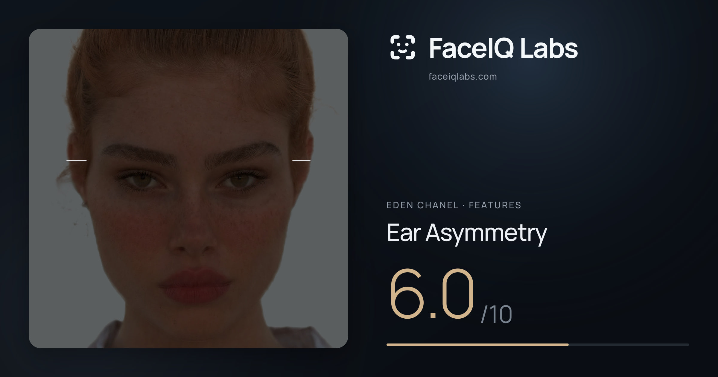 Eden Chanel Ear Asymmetry: 6.0/10, drawn on the photo