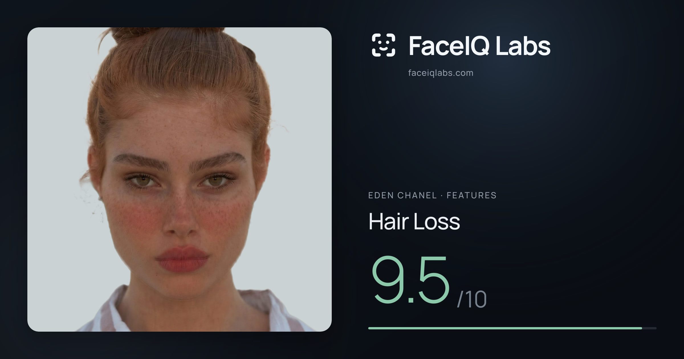 Eden Chanel Hair Loss: 9.5/10, drawn on the photo