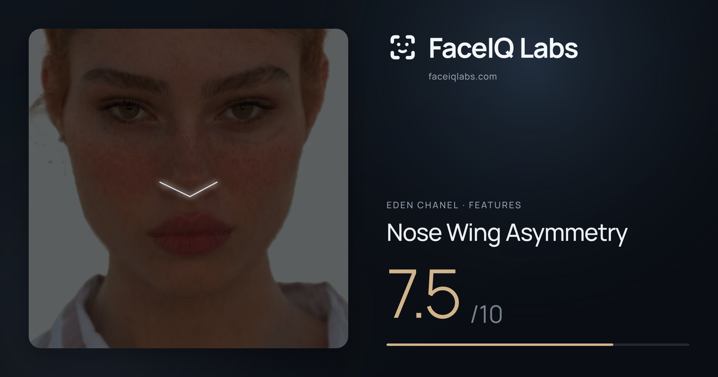 Eden Chanel Nose Wing Asymmetry: 7.5/10, drawn on the photo