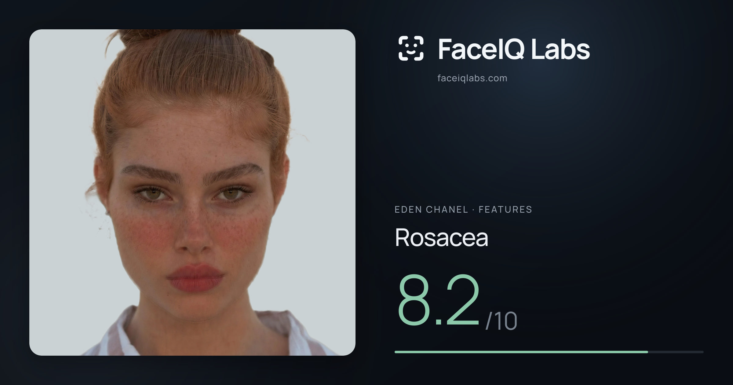 Eden Chanel Rosacea: 8.2/10, drawn on the photo