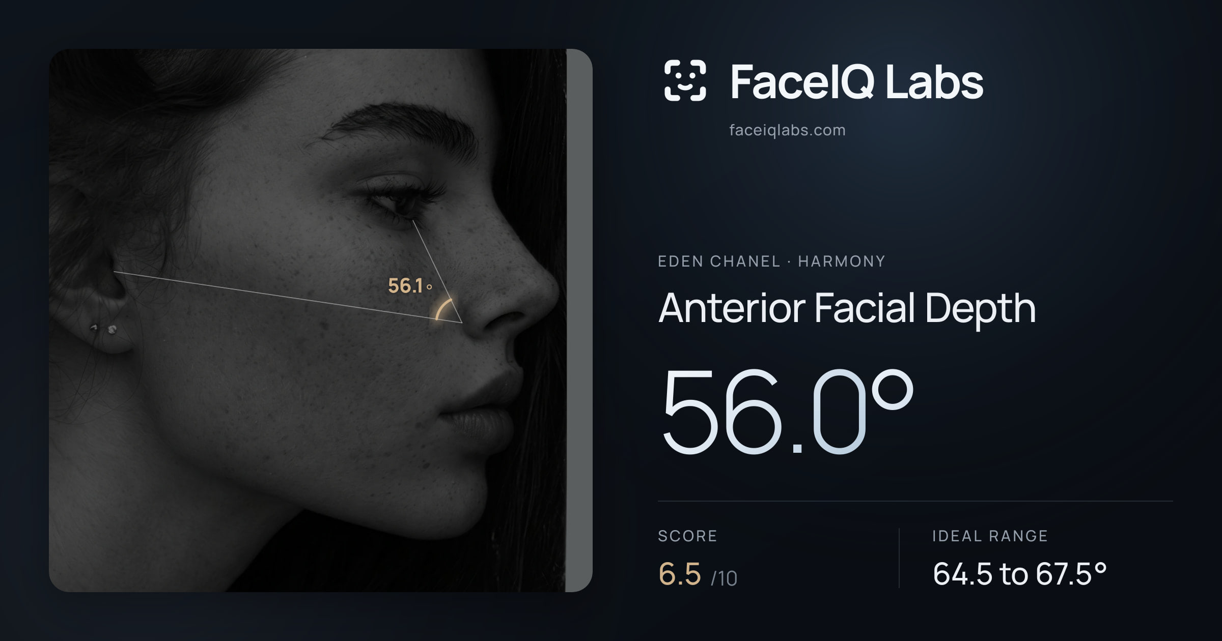 Eden Chanel Anterior Facial Depth: 56.0°, drawn on the photo