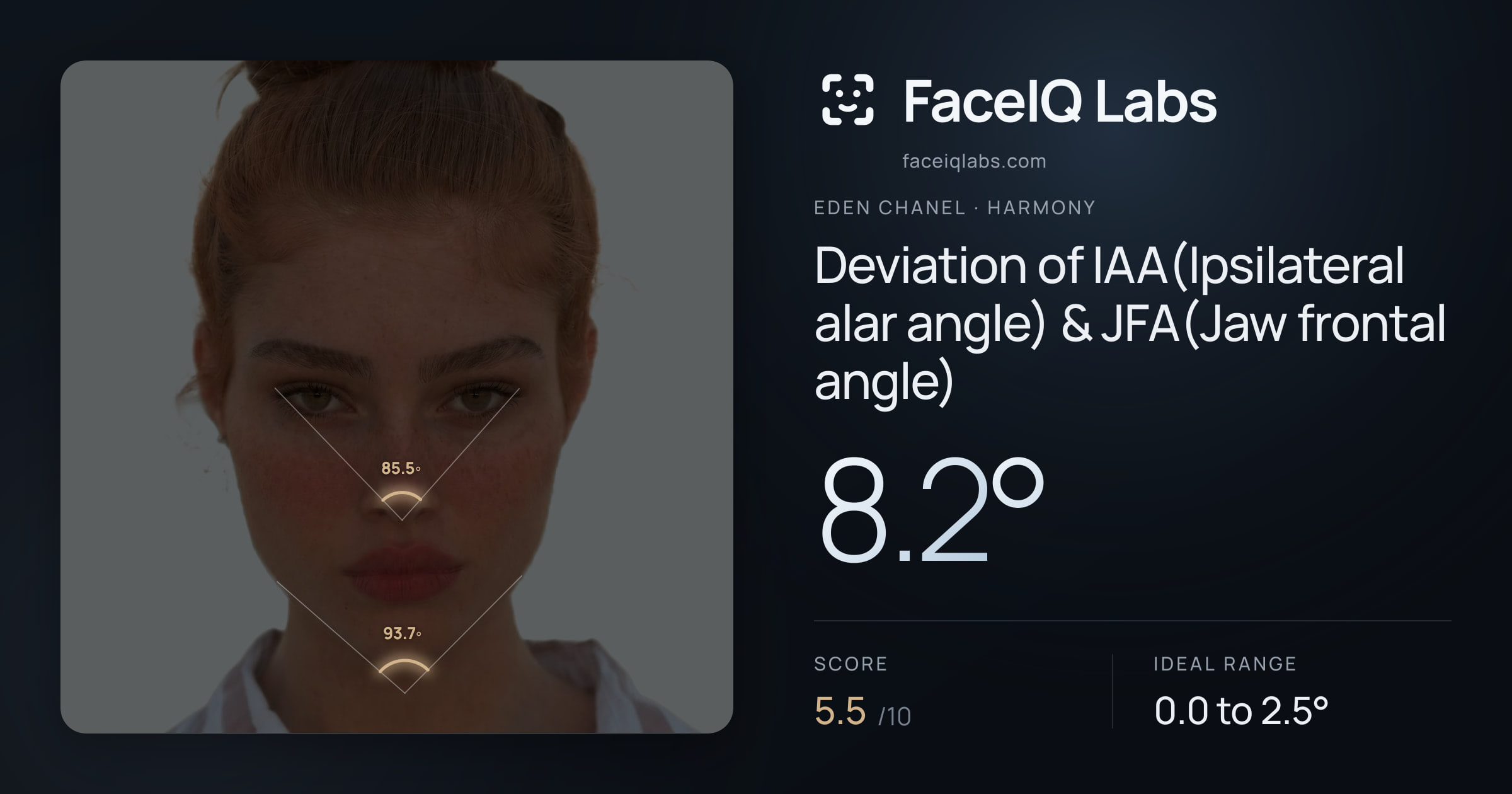 Eden Chanel Deviation of IAA(Ipsilateral alar angle) & JFA(Jaw frontal angle): 8.2°, drawn on the photo