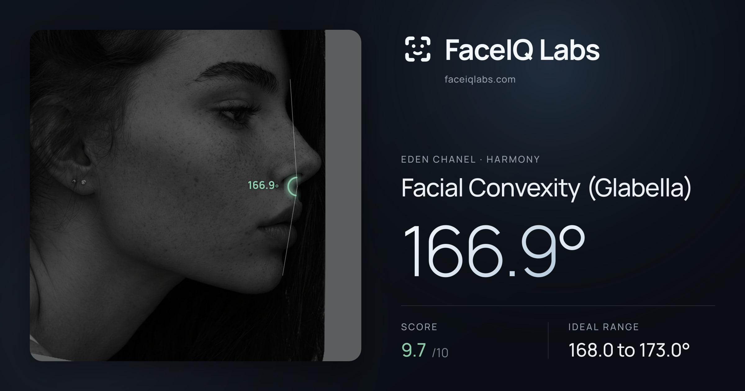 Eden Chanel Facial Convexity (Glabella): 166.9°, drawn on the photo