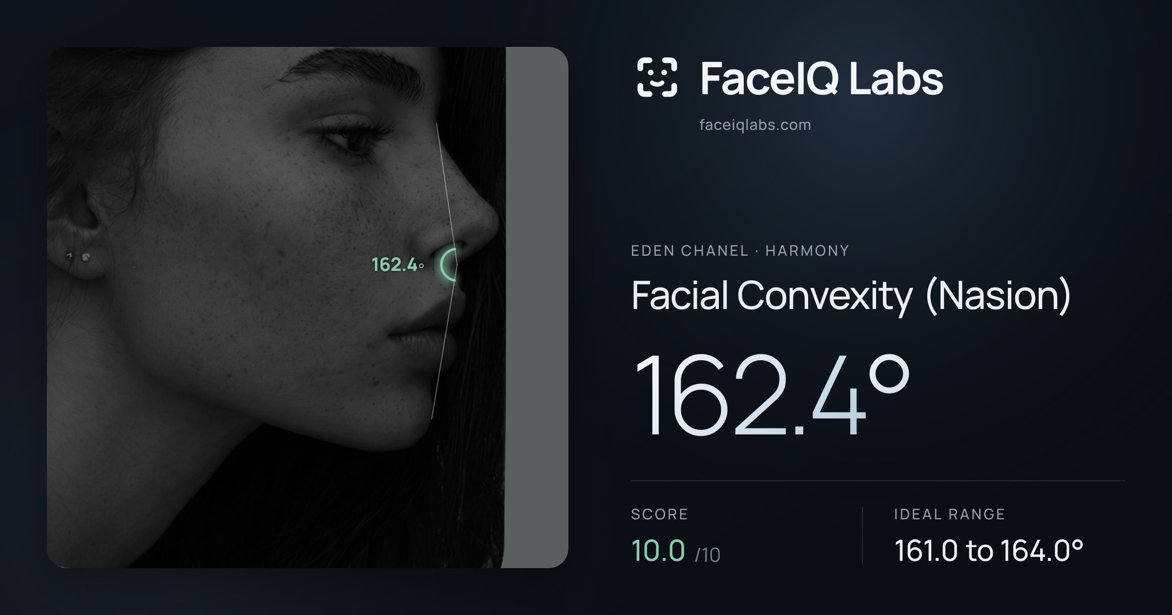 Eden Chanel Facial Convexity (Nasion): 162.4°, drawn on the photo