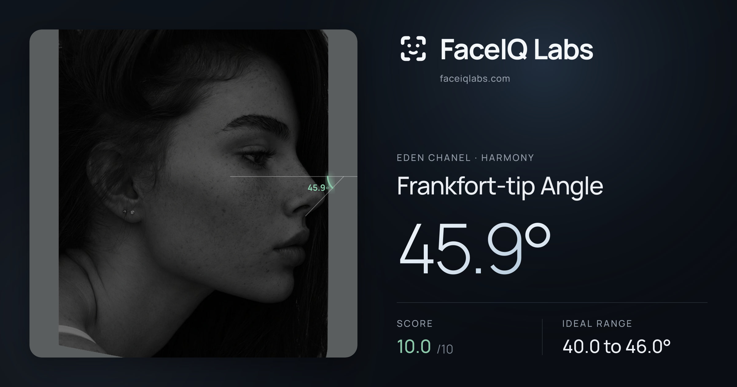 Eden Chanel Frankfort-tip Angle: 45.9°, drawn on the photo
