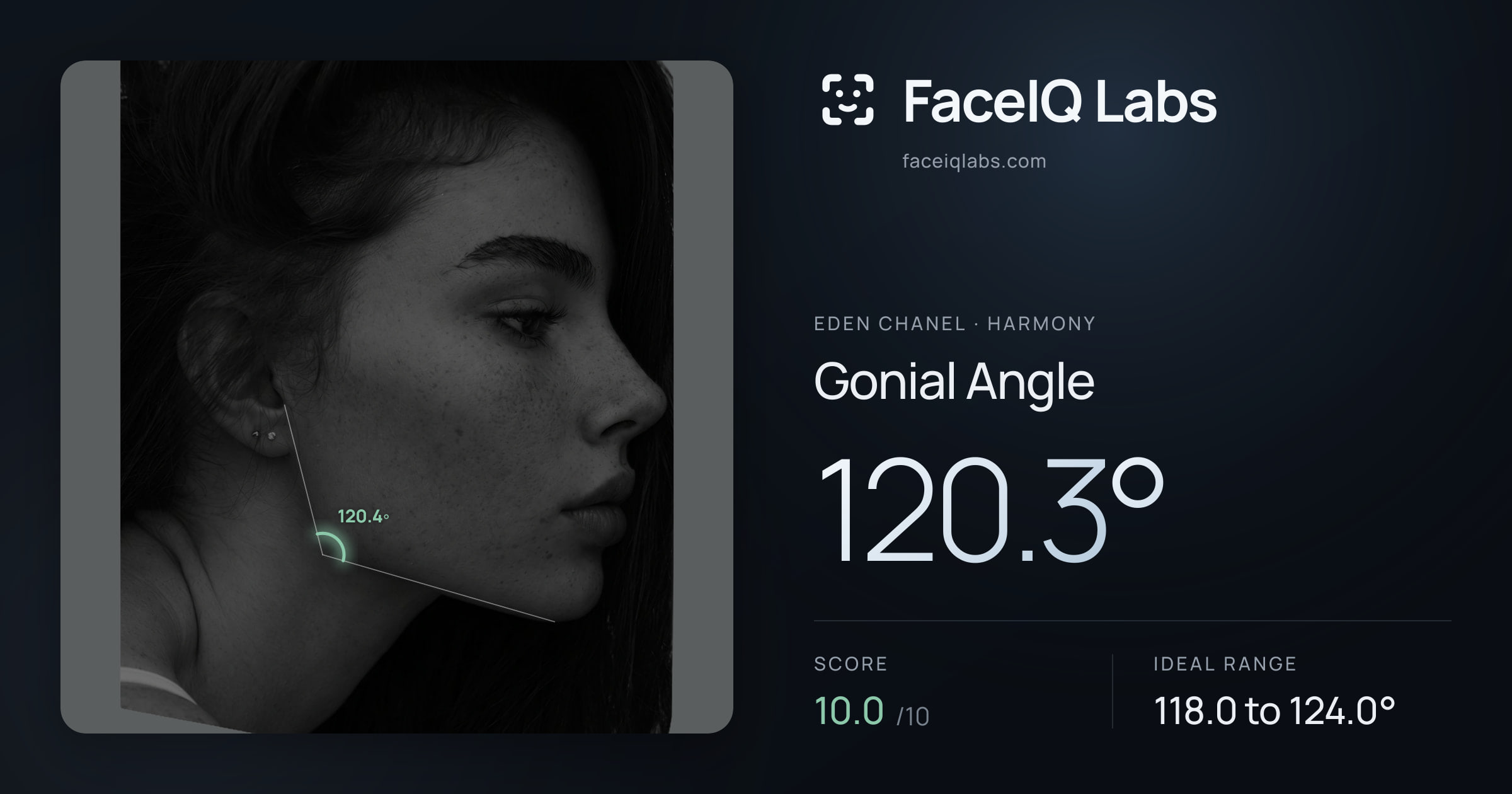 Eden Chanel Gonial Angle: 120.3°, drawn on the photo
